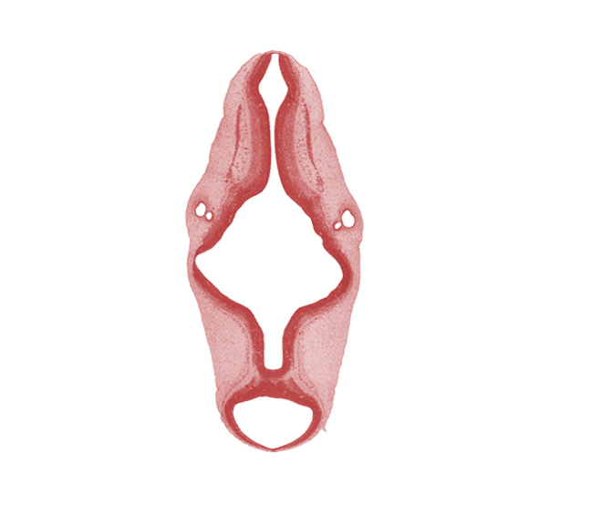 accessory nerve (CN XI), basis pedunculi of pons region (metencephalon), isthmus of rhombencephalon, mesencephalon (M2), metencephalon, myelencephalon, rhombencoel (fourth ventricle), rhombomere 4, rhombomere 5, rhombomere 6, rhombomere 7, roof plate, roof plate of rhombencephalon, sulcus limitans, tectum, tegmentum, vascular plexus