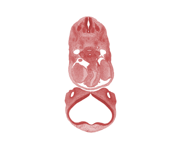 C-4 spinal ganglion, ascending aorta, central canal, dermatome, dorsal aorta, dorsal ramus of C-4 spinal nerve, edge of sinus venosus, infrahyoid premuscle mass, lateral nasal prominence, lateral ventricle, left atrial wall, lumen of nasal sac, myotome, origin of aortic arch 6 from truncus arteriosus, paraphysial arch, precardinal vein, pulmonary trunk, striatal part of cerebral vesicle (telencephalon), suprastriatal part of cerebral vesicle (telencephalon), sympathetic trunk, third ventricle, undivided conus cordis, undivided truncus arteriosus, vagus nerve (CN X), ventral ramus of C-4 spinal nerve