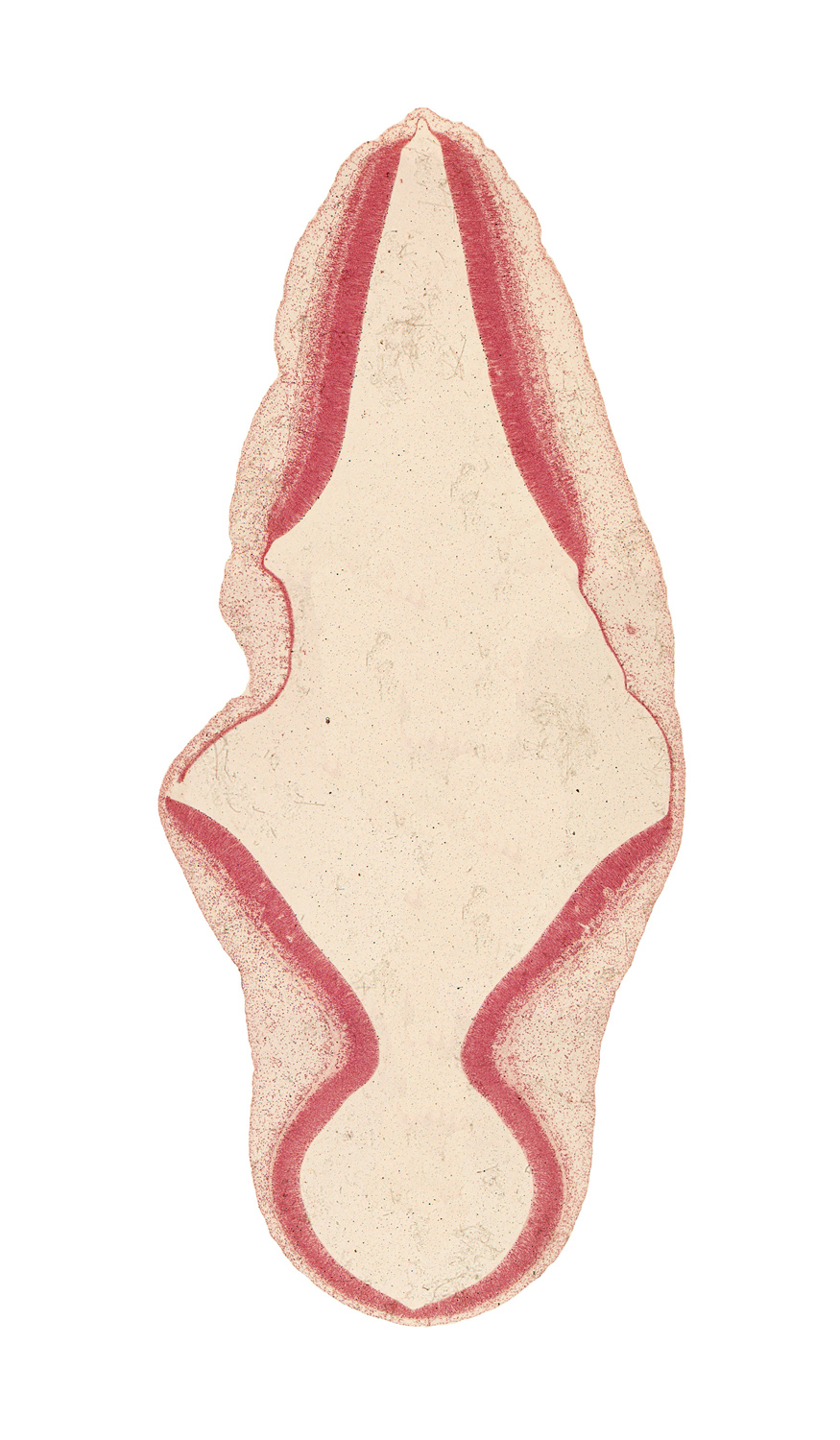 alar plate of metencephalon (cerebellum), alar plate of myelencephalon, artifact separation(s), cephalic tip of endolymphatic duct, head mesenchyme, mesencoel, rhombencoel (fourth ventricle), roof plate of myelencephalon, roof plate of rhombencephalon, tectum of mesencephalon, tegmentum of mesencephalon, trochlear nerve (CN IV)