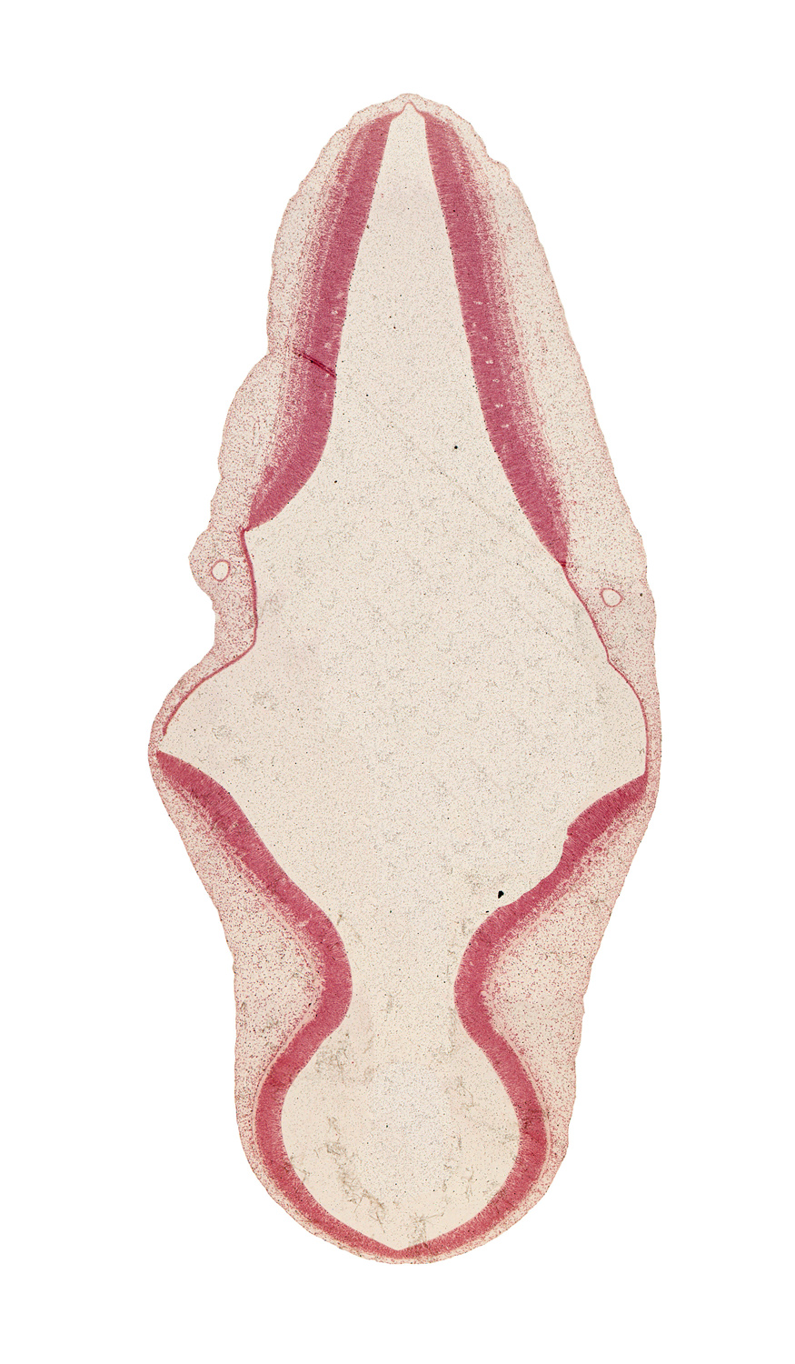 alar plate(s), artifact separation(s), basal plate, endolymphatic duct, head mesenchyme, intermediate zone, marginal zone, mesencephalon (M2), myelencephalon, roof plate, roof plate of rhombencephalon, sulcus limitans, tectum, tegmentum, ventricular zone