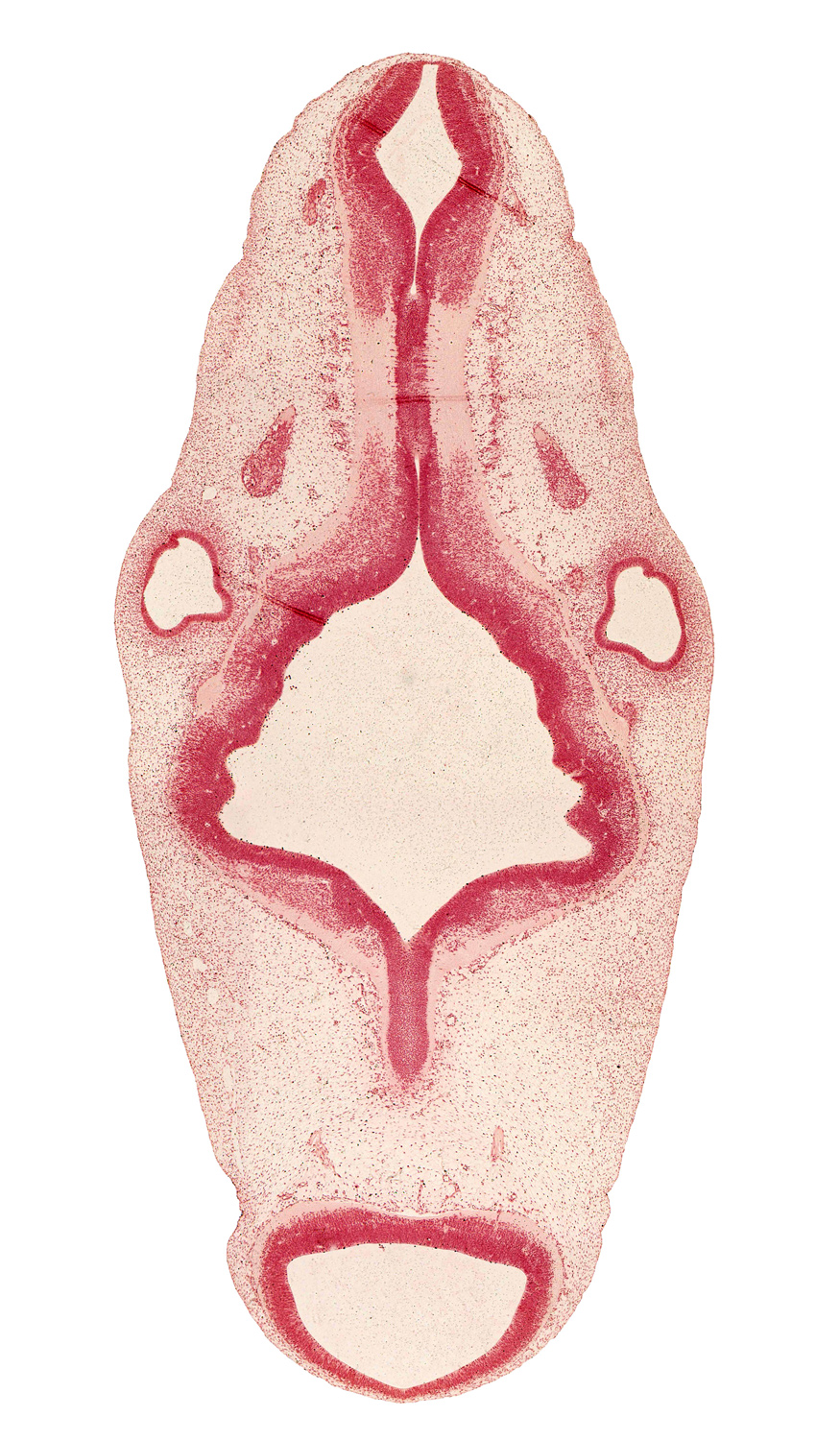 accessory nerve (CN XI), branch of posterior cerebral artery, glossopharyngeal nerve (CN IX), head mesenchyme, intermediate zone, marginal zone, mesencephalon (M1), rhombomere 2, rhombomere 3, rhombomere 4, rhombomere 5, rhombomere 6, root of hypoglossal nerve (CN XII), semicircular groove, sulcus limitans, tectum, tegmentum, vagus nerve (CN X), vascular plexus, ventricular zone, vestibular part of otic vesicle