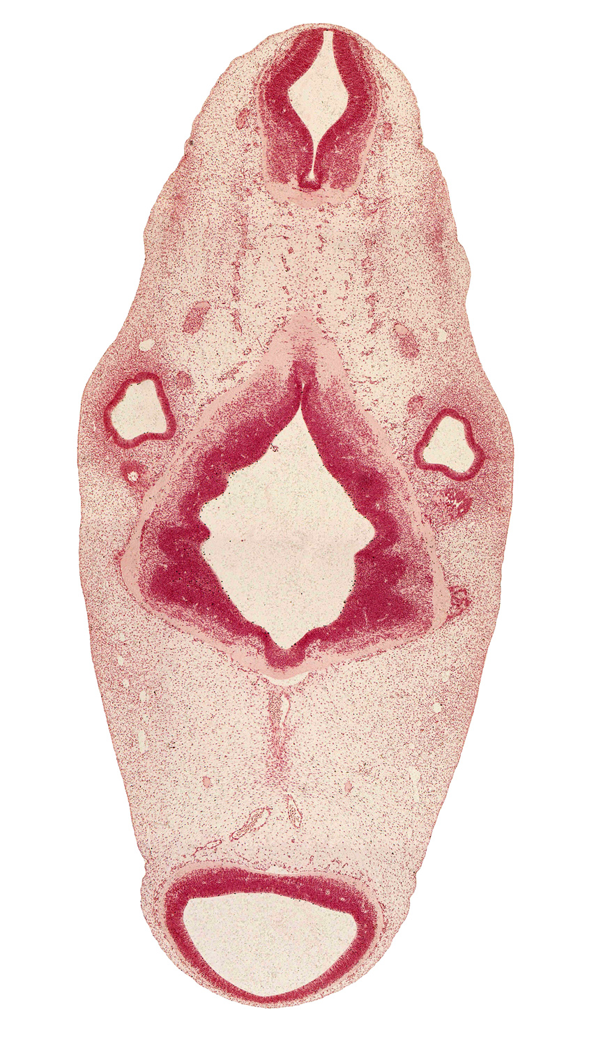 intermediate zone, marginal zone, median sulcus, mesencephalon (M1), mesencoel (cerebral aqueduct), myelencephalon, occipital myotome, oculomotor nerve (CN III), otic capsule, posterior dural venous plexus, rhombomere 1, rhombomere 2, rhombomere 3, rhombomere 4, rhombomere 5, superior ganglion of glossopharyngeal nerve (CN IX), trochlear nerve (CN IV), vascular plexus, ventricular zone, vestibular part of otic vesicle