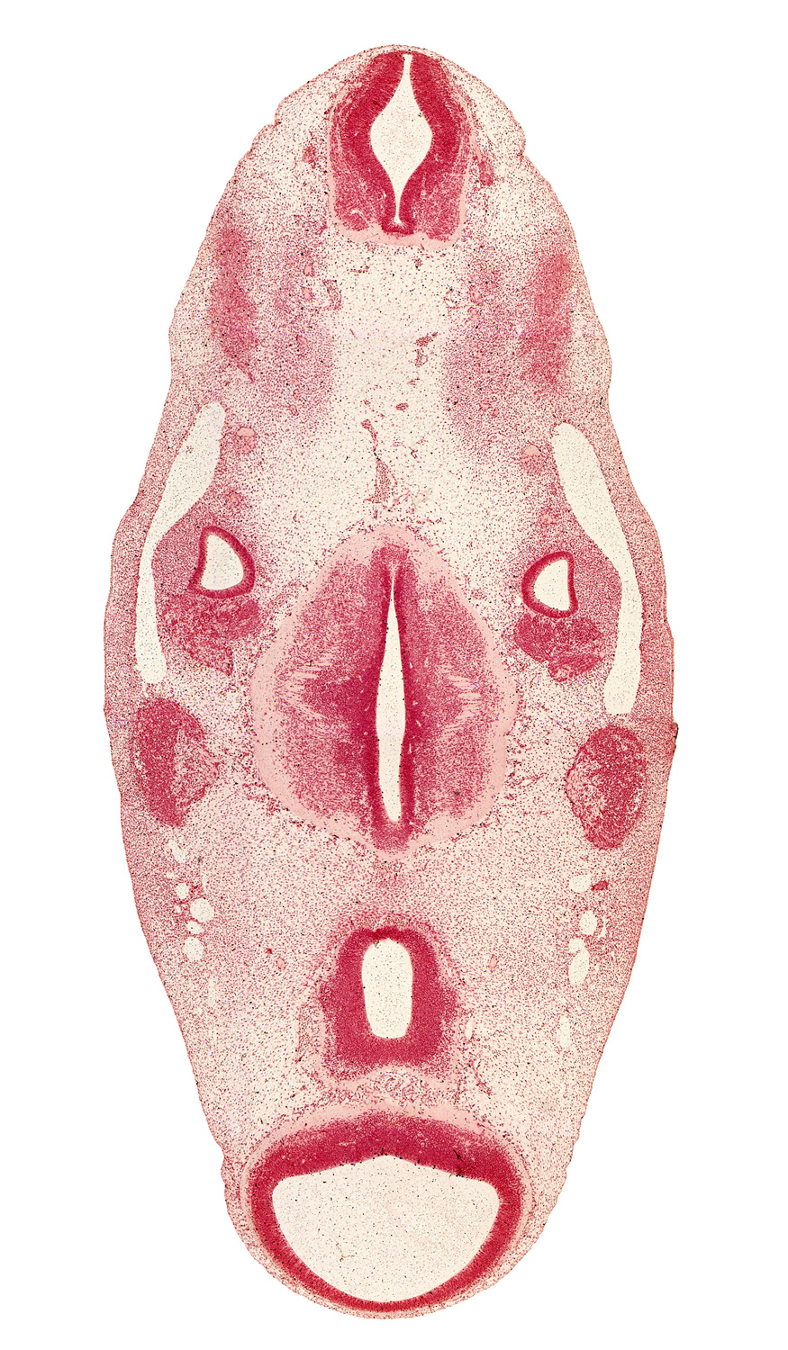 accessory nerve (CN XI), basilar artery, cochlear ganglion (CN VIII), diencephalon, facial nerve (CN VII), floor plate, geniculate ganglion (CN VII), glossopharyngeal nerve (CN IX), junction of brain and spinal cord, junction ventrally of diencephalon and mesencephalon, mamillary region, mesencephalon (M1), mesencoel (cerebral aqueduct), motor root of trigeminal nerve (CN V), occipital myotome, oculomotor nerve (CN III), parachordal condensation, primary head vein, roof plate, spinal accessory nerve (CN XI), sulcus limitans, third ventricle, trochlear nerve (CN IV), vagus nerve (CN X)