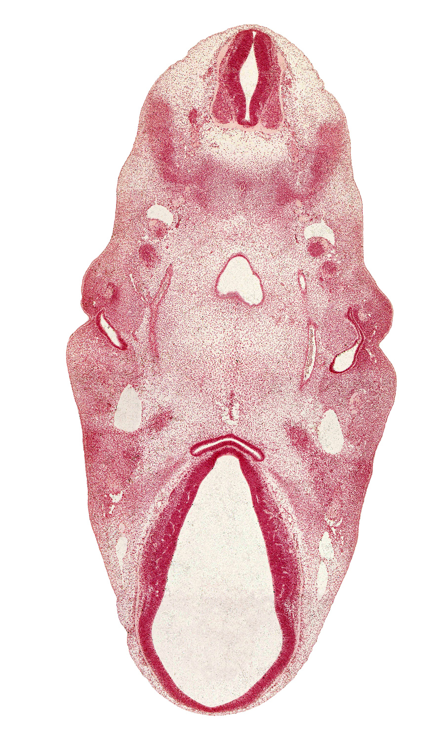 C-1 spinal nerve, adenohypophysial pouch, alar plate(s), anterior dural venous plexus, auricular hillock, basal plate, cephalic edge of C-2 spinal ganglion, cephalic edge of tongue, cephalic end of notochord, diencephalon, extra-ocular premuscle mass, floor plate, glossopharyngeal nerve (CN IX), internal carotid artery, mandibular nerve (CN V₃), myotome, neurohypophyseal bud, notochord, pharynx, posterior communicating artery, precardinal vein, roof plate, sulcus limitans, terminal branches of maxillary nerve (CN V₂), vagus nerve (CN X), vascular plexus