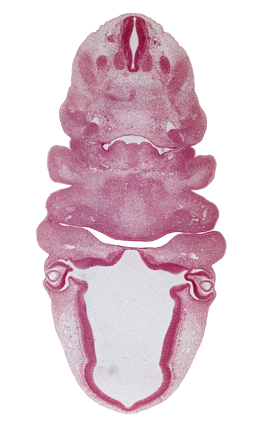 C-2 spinal ganglion, aortic arch 3, carotid duct, cephalic edge of C-3 spinal ganglion, cervical sinus, dermatome, epaxial part of myotome, epithalamus, hyaloid vessel(s), hypoglossal nerve (CN XII), inferior ganglion of vagus nerve (CN X), lens vesicle, mandibular prominence of pharyngeal arch 1, maxillary prominence of pharyngeal arch 1, medial eminence, neural layer of retina, notochord, oral fissure, origin of external carotid artery, oronasal cavity, pharyngeal arch 2, pharyngeal arch 3, pharyngeal pouch 3 (dorsal part becomes inferior parathyroid gland), pigmented layer of retina, pineal bud, retinal fissure, spinal accessory nerve (CN XI), sympathetic trunk