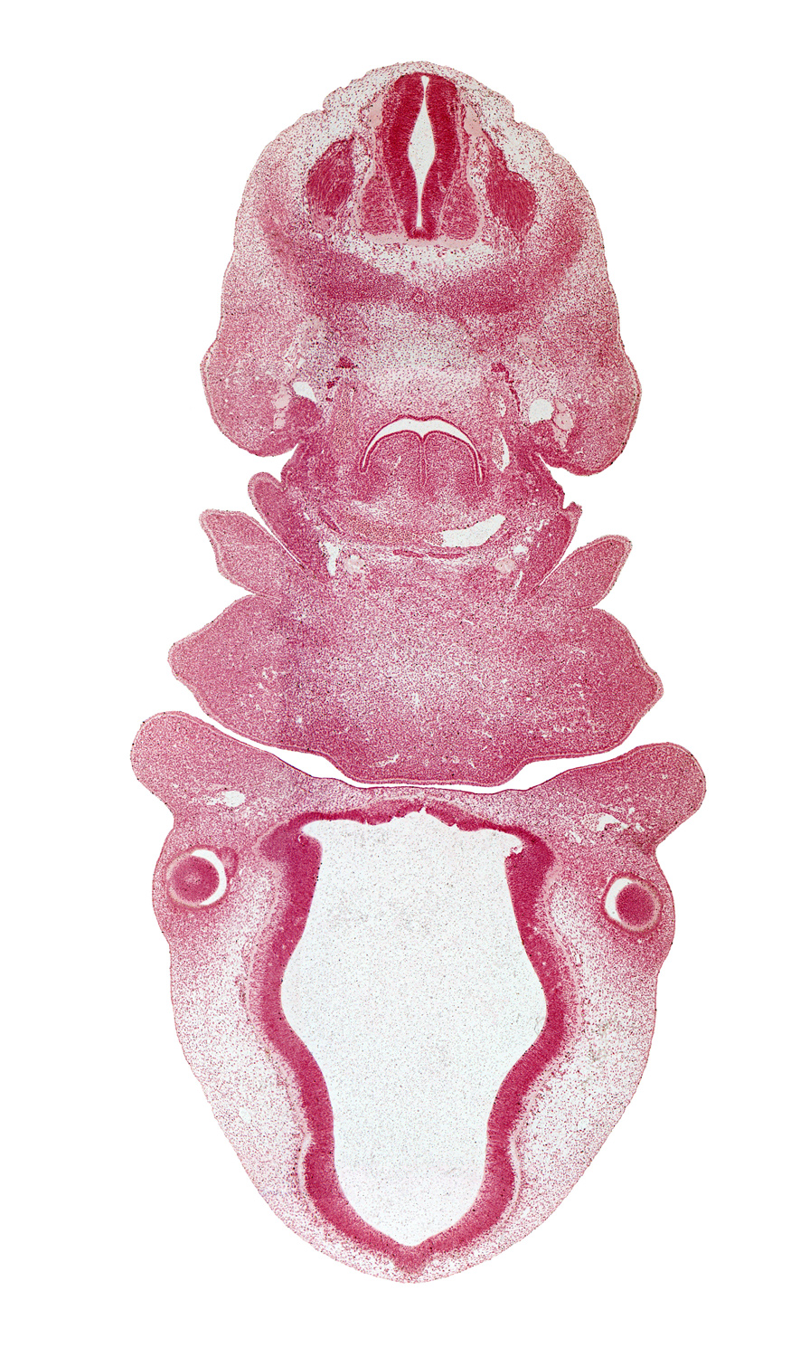 C-3 spinal ganglion, aortic arch 4, diencephalon, dorsal aorta, edge of optic cup, edge of optic stalk (CN II), epaxial part of myotome, head mesenchyme, horn of aortic sac, hypoglossal nerve (CN XII), laryngeal pharynx, lateral lingual swelling of tongue, mandibular prominence of pharyngeal arch 1, nasomaxillary groove, notochord, optic chiasma (chiasmatic plate), pharyngeal arch 2, precardinal vein, spinal accessory nerve (CN XI), vagus nerve (CN X), vascular plexus