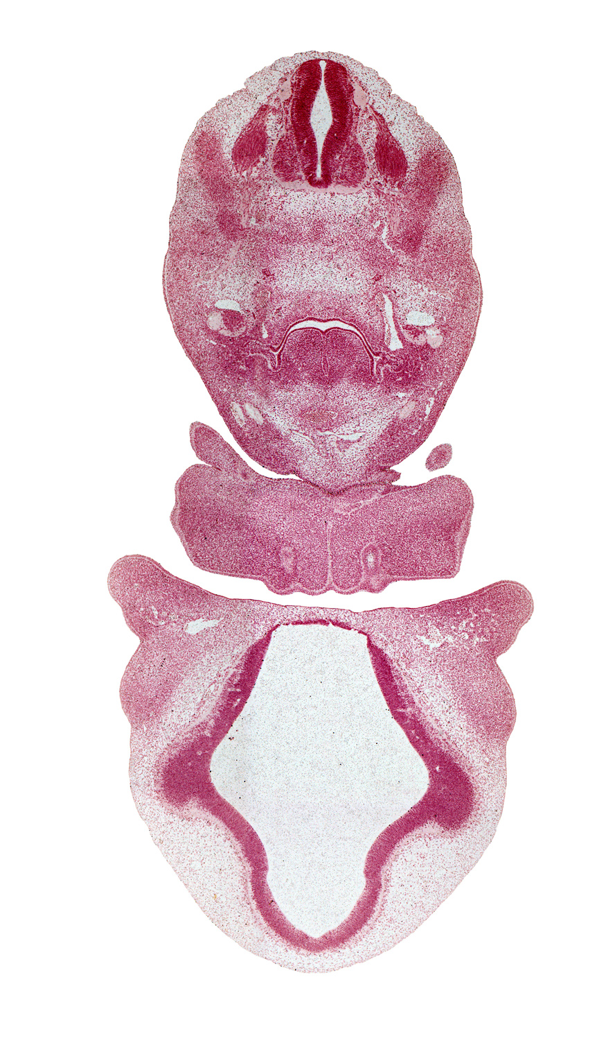 C-3 spinal ganglion, C-3 ventral primary ramus, aortic arch 6, aortic sac, dermatome, hypoglossal nerve (CN XII), lamina terminalis, laryngeal condensation, laryngeal pharynx, lateral nasal prominence, mandibular prominence of pharyngeal arch 1, maxillary prominence of pharyngeal arch 1, maxillary venous plexus, median mandibular groove, nasomaxillary groove, oral fissure, pericardial cavity, precardinal vein, primordial meninx, vagus nerve (CN X), ventral root