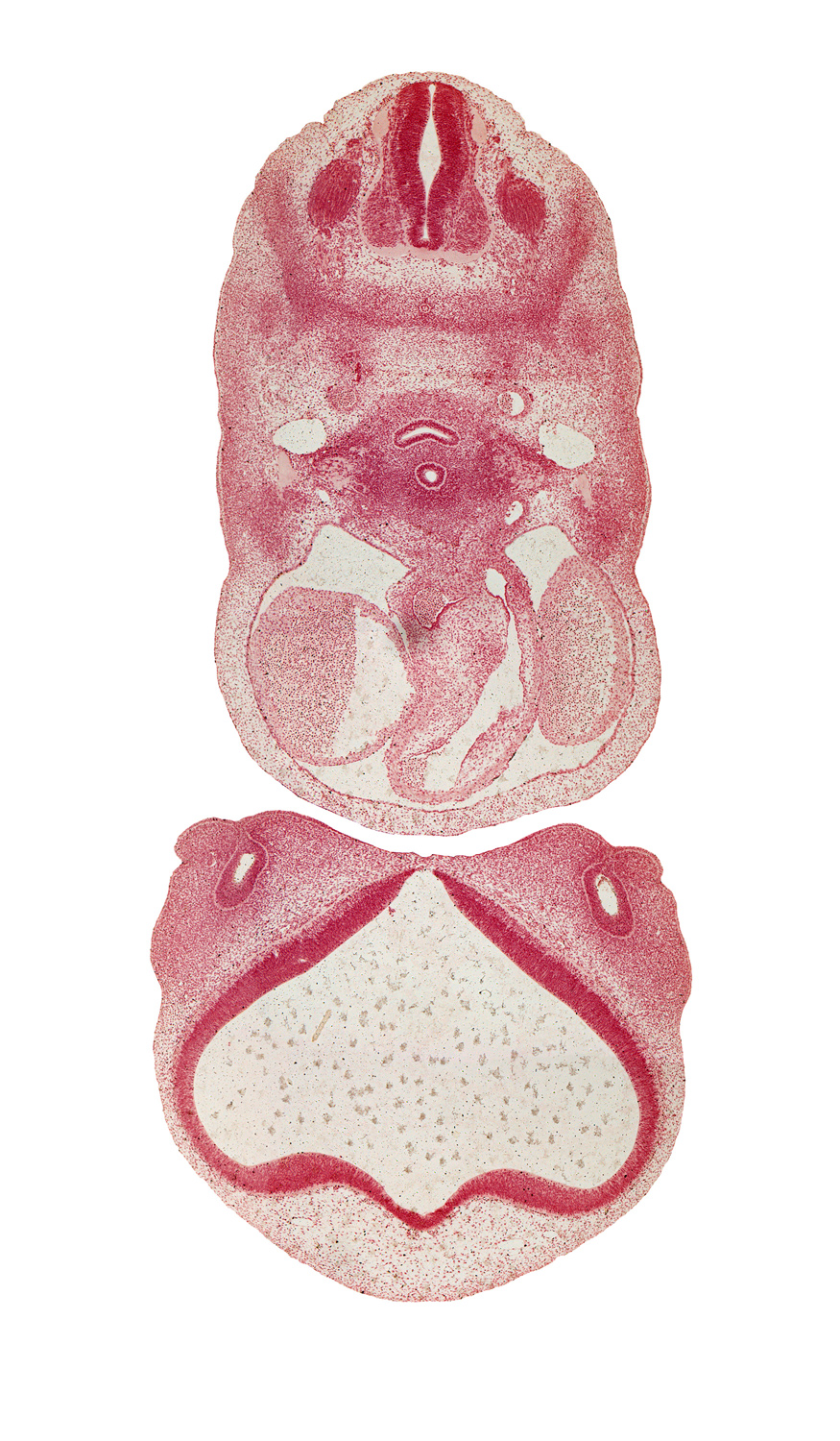 C-4 spinal ganglion, aortic arch 6, aorticopulmonary septum, ascending aorta, conus cordis (proximal outflow tract), esophageal condensation, esophagus endoderm, head mesenchyme, interventricular foramen, lateral nasal prominence, left atrium, maxillary prominence of pharyngeal arch 1, medial nasal prominence(s), musculi pectinati, nasal capsule, nasomaxillary groove, notochord, olfactory area, primordial meninx, pulmonary trunk, right atrium, torus hemisphericus, trachea (endoderm), tracheal condensation, undivided truncus arteriosus (distal outflow tract)