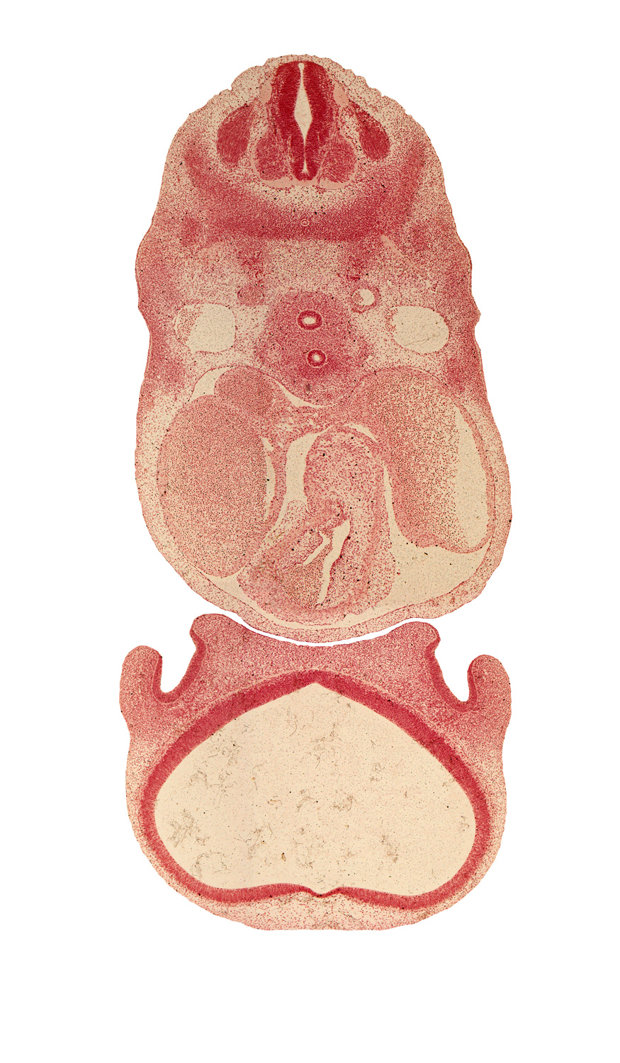 C-5 spinal ganglion, anterior spinal artery, aortic vestibule of left ventricle, archipallium, cerebral vesicle (neopallium), dorsal fasciculus, infrahyoid premuscle mass, infundibulum of right ventricle, left atrium, naris, nasal disc (olfactory placode), nasal sac, nasal septum region, paleopallium, pericardial cavity, precardinal vein, right atrium, semilunar valve region, sinus venosus, surface ectoderm