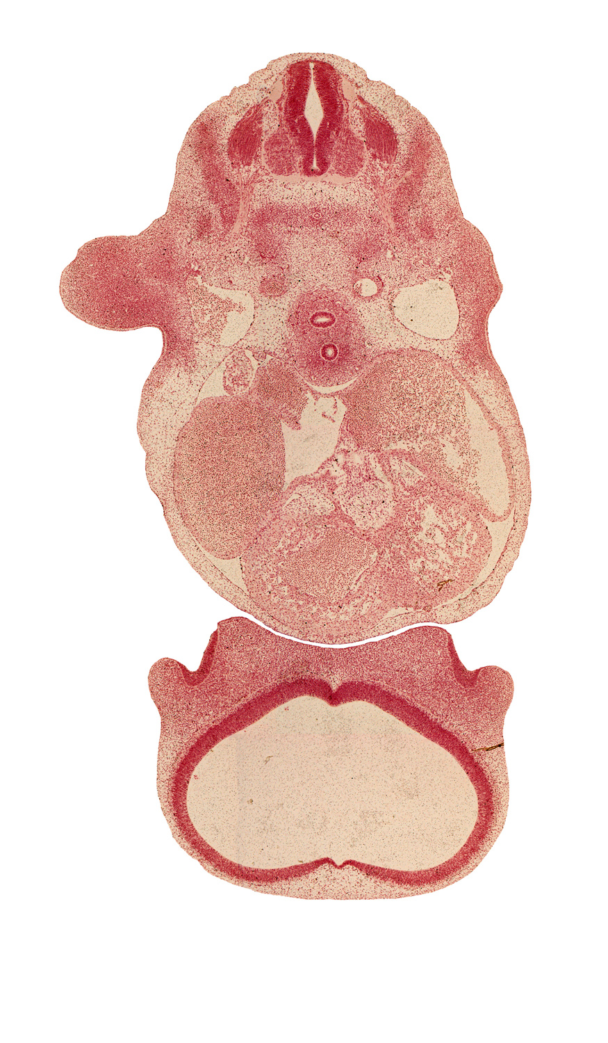 C-5 spinal ganglion, cephalic edge of upper limb, dorsal primary ramus, epaxial part of myotome, hypaxial part of myotome, interventricular foramen, junction of infundibulum and trabecular part of right ventricle, junction of precardinal and subclavian veins, left atrium, notochord, phrenic nerve, precardinal vein, primary interatrial septum (septum primum), right atrium, sinus venosus, sympathetic trunk, telencephalon medium, ventral primary ramus