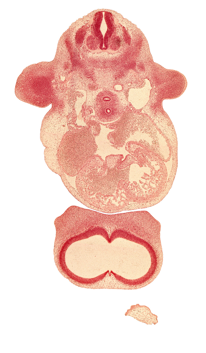 cephalic edge of C-6 spinal ganglion, dense caudal part of sclerotome, esophagus, interventricular foramen, junction of lateral and medial nasal prominences, left atrioventricular canal, left atrium, notochord, phrenic nerve, precardinal vein, primary interatrial foramen (foramen primum), primary interatrial septum (septum primum), right atrioventricular canal, right atrium, right ventricle, sinu-atrial foramen, sinus venosus, telencephalon medium, trabecular part of left ventricle, trachea, upper limb, ventral atrioventricular endocardial cushion