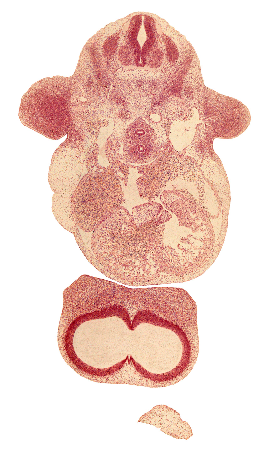 C-6 spinal ganglion, dorsal aorta, esophagus, frontal prominence, fused atrioventricular endocardial cushions, interventricular foramen, junction of precardinal and subclavian veins, lateral ventricle, left atrioventricular canal, left atrium, left ventricle, phrenic nerve, precardinal vein, right atrioventricular canal, right atrium, right ventricle, sinu-atrial foramen, sympathetic trunk, trachea