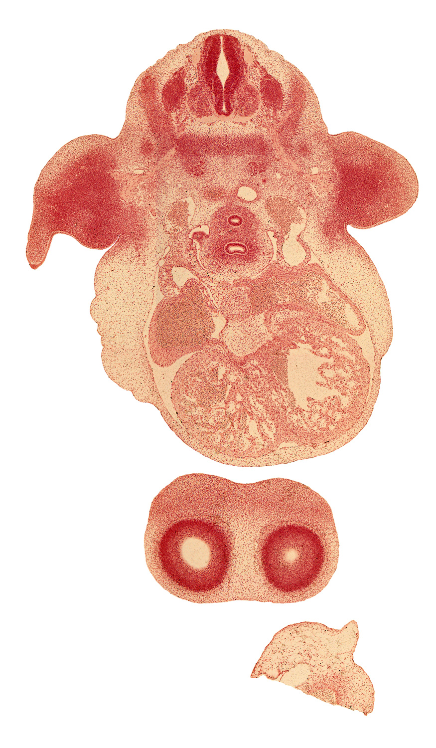 C-6 spinal ganglion, cerebral vesicle (telencephalon), dorsal aorta, edge of lateral ventricle, fused atrioventricular endocardial cushions, heart prominence, interventricular foramen, left atrium, left common cardinal vein, phrenic nerve, postcardinal vein, pulmonary venous plexus, right atrium, sinus venosus, trachea near bifurcation, upper limb