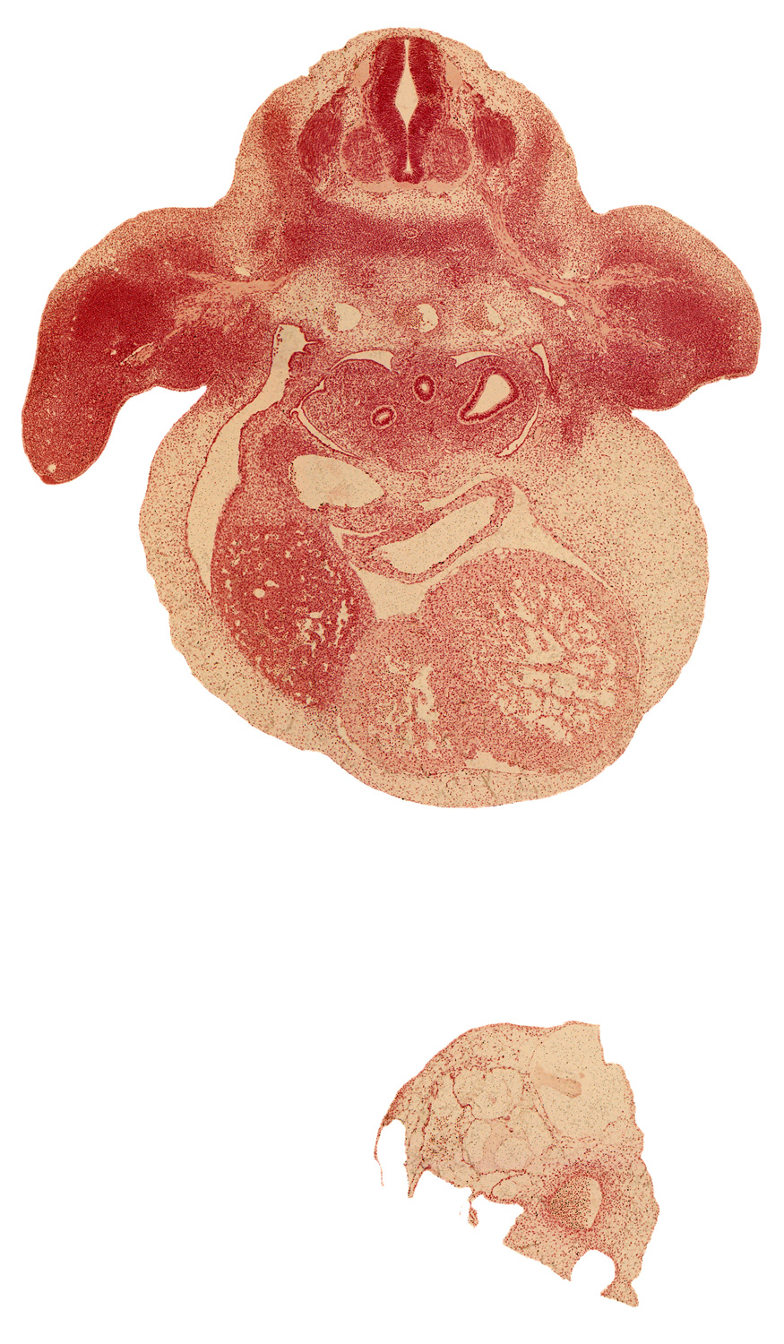 C-7 spinal ganglion, C-7 ventral primary ramus, alar plate(s), aorta, basal plate, brachial artery, cardiac prominence, dorsal meso-esophagus, edge of peritoneal cavity, esophagus, left horn of sinus venosus, liver, marginal vein, pericardial cavity, primary bronchus, septum transversum, sinus venosus, skeletal blastema of humerus, sulcus limitans, upper secondary bronchus bud