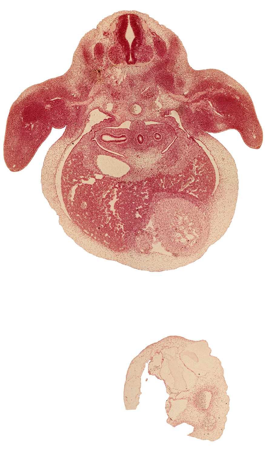 C-7 spinal ganglion, esophagus, hepatic sinusoid, interventricular sulcus, left lobe of liver, lower secondary bronchus bud, median nerve, middle secondary bronchus bud, pericardial sac, peritoneal cavity, pleuroperitoneal membrane, primordial meninx, primordial pleural cavity, radial nerve, septum transversum, sympathetic trunk