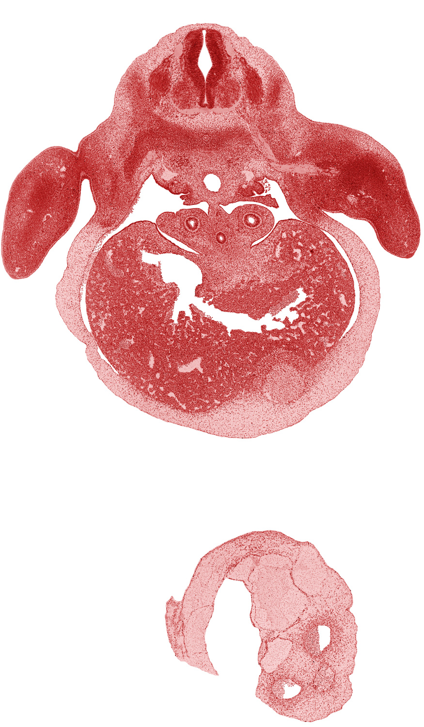 C-8 spinal ganglion, C-8 ventral primary ramus, axial artery, dense caudal part of sclerotome, ductus venosus, efferent hepatic veins, forearm, hepatic sinusoid, left lobe of liver, left ventricle, neural arch, pleuroperitoneal membrane, pleuroperitoneal opening, primordial meninx, primordial paramesonephric groove, right lobe of liver, ulnar nerve