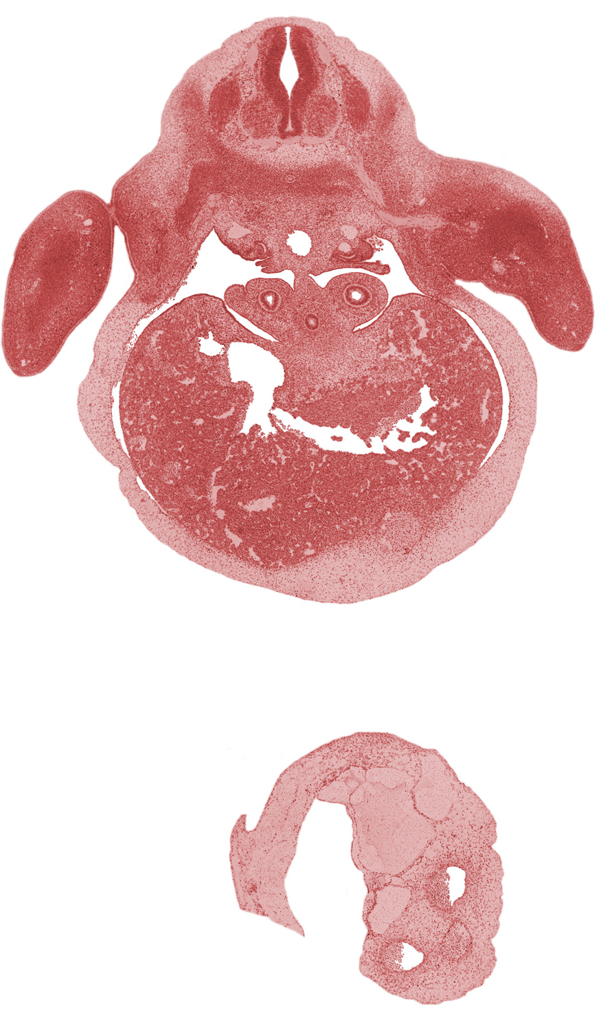 C-8 spinal ganglion, C-8 spinal nerve, aorta, cephalic edge of mesonephros, ductus venosus, edge of lateral ventricle, efferent hepatic veins, esophagus, left lobe of liver, lower trunk of brachial plexus (C-8, T-1), marginal vein, median nerve, neural arch, pleuroperitoneal opening, right lobe of liver, septum transversum