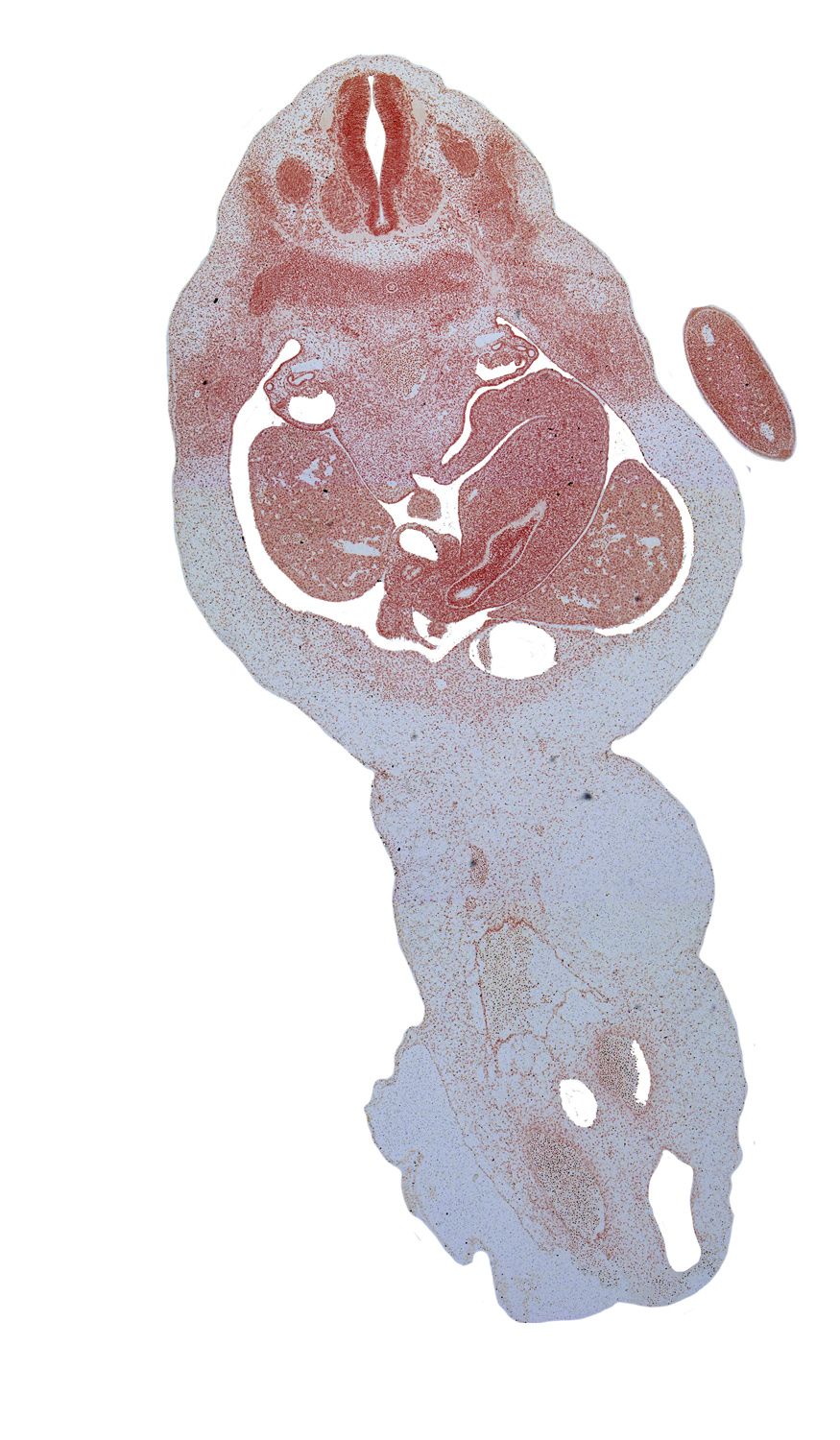 T-2 spinal ganglion, T-3 dorsal primary ramus, T-3 ventral primary ramus, allantois, aorta, caudal edge of stomach, duodenum, epiploic foramen, greater sac, hepatic portal vein, junction of common hepatic and cystic ducts, left lobe of liver, left umbilical artery, lesser sac (omental bursa), right lobe of liver, right umbilical artery, spleen, umbilical vein