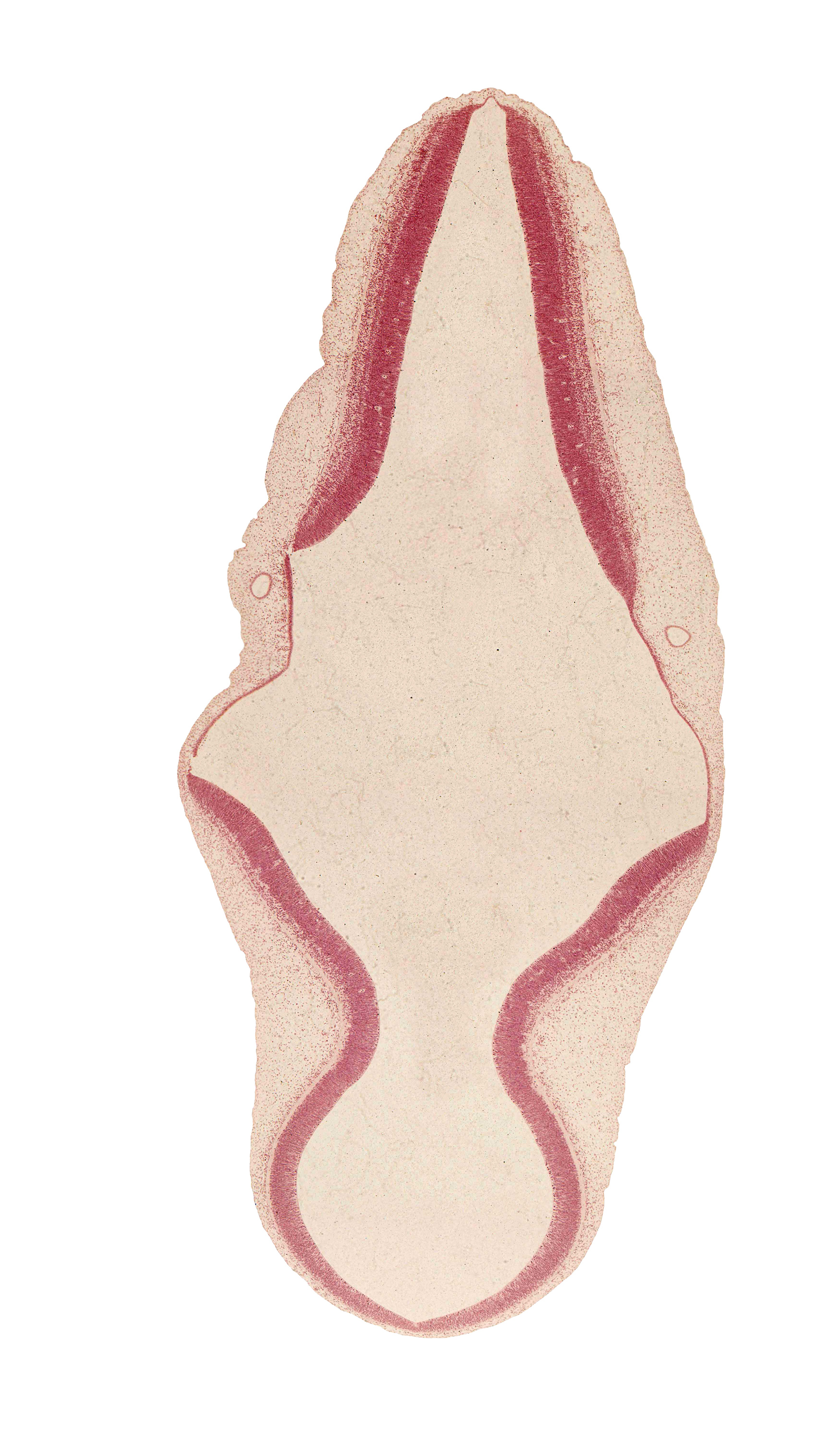 alar plate(s), artifact separation(s), isthmus of rhombencephalon, mesencephalon (M2), mesencoel (cerebral aqueduct), metencephalon, myelencephalon, rhombencoel (fourth ventricle), roof plate of myelencephalon, roof plate of rhombencephalon, vascular plexus