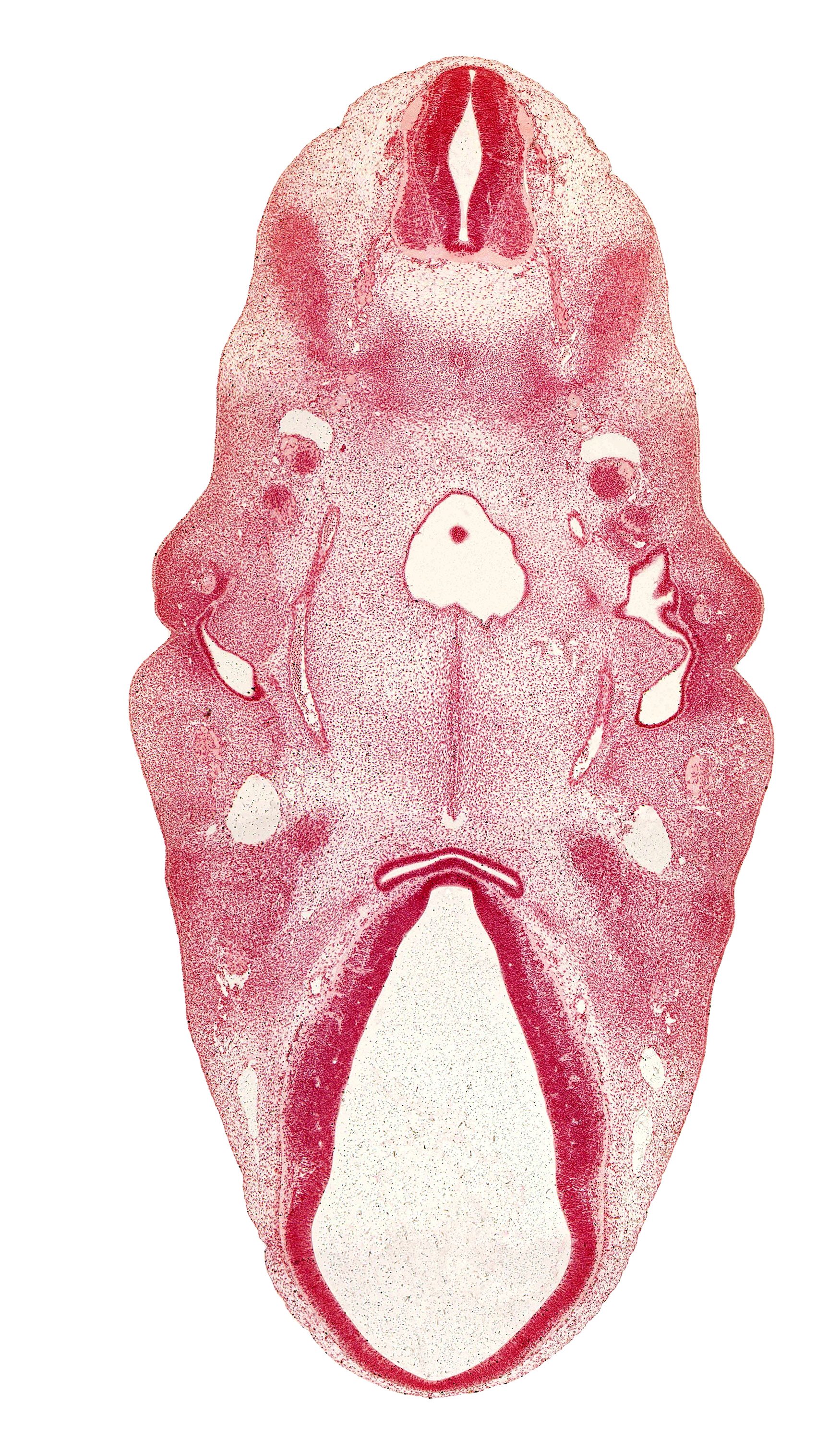 cephalic part of C-2 spinal ganglion, cephalic part of tongue, diencephalon, dorsal fasciculus, dorsal thalamus, epithalamus, extra-ocular premuscle mass, facial nerve (CN VII), hypoglossal nerve (CN XII), hypopharyngeal eminence of tongue, hypothalamus, internal carotid artery, mandibular nerve (CN V₃), maxillary vein, notochord, pharyngeal groove 1, pharyngeal pouch 1, pharyngeal pouch 2, posterior communicating artery, roof of pharynx, third ventricle, ventral thalamus