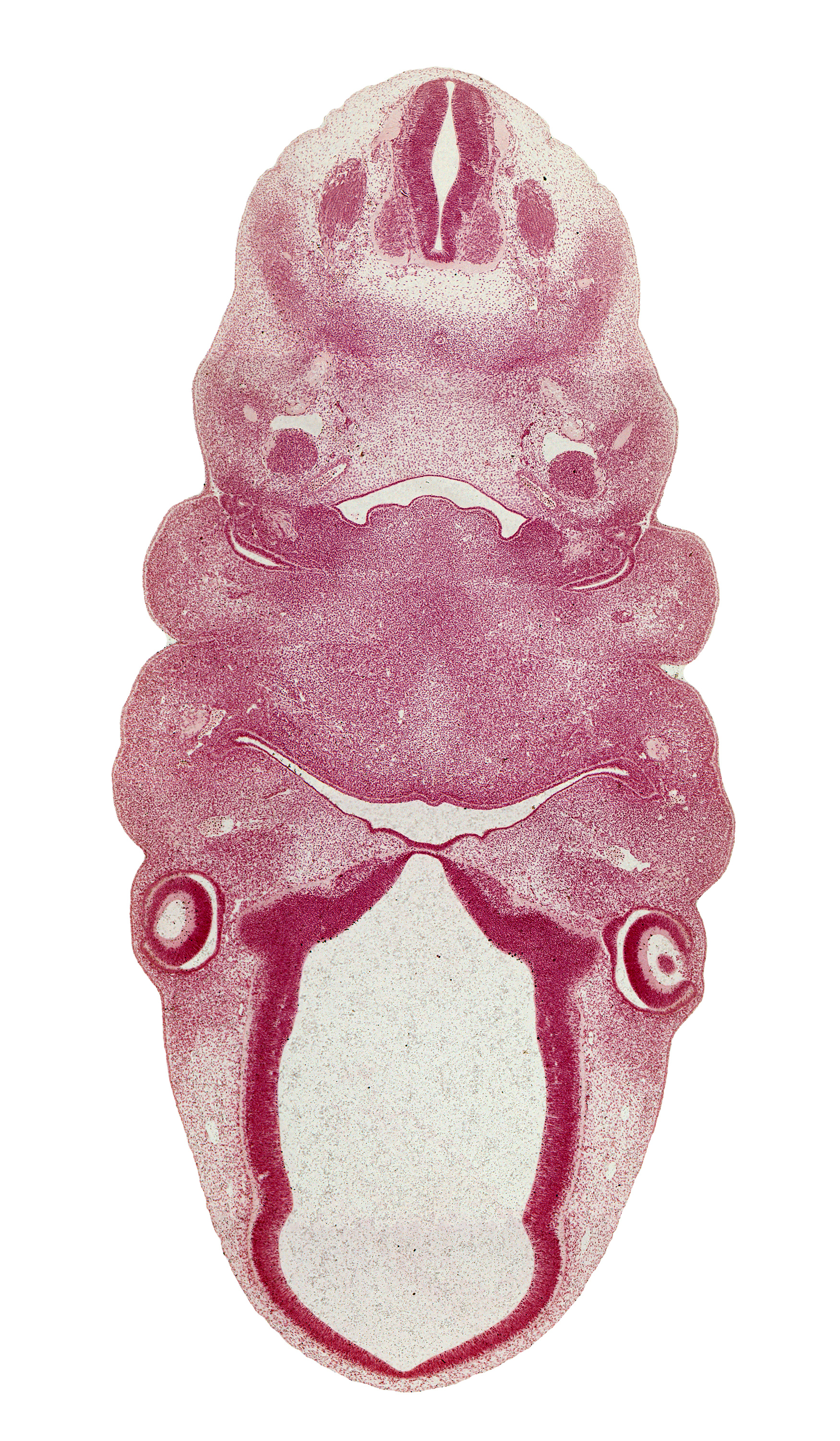 C-2 spinal ganglion, dorsal primary ramus, dorsal sulcus, dorsal thalamus, edge of tuberculum impar, epaxial part of myotome, epiglottis, hypoglossal nerve (CN XII), intraretinal space (optic vesicle cavity), junction of aortic arch 3 and internal carotid artery, laryngeal pharynx, lens vesicle, mandibular nerve (CN V₃), mandibular prominence of pharyngeal arch 1, maxillary prominence of pharyngeal arch 1, maxillary vein, middle sulcus, optic cup cavity, optic stalk (CN II), oronasal cavity, pharyngeal arch 2, pharyngeal groove 1, precardinal vein, premuscle mass of tongue, resorbing thyroglossal duct, terminal part of glossopharyngeal nerve (CN IX), third ventricle, ventral thalamus