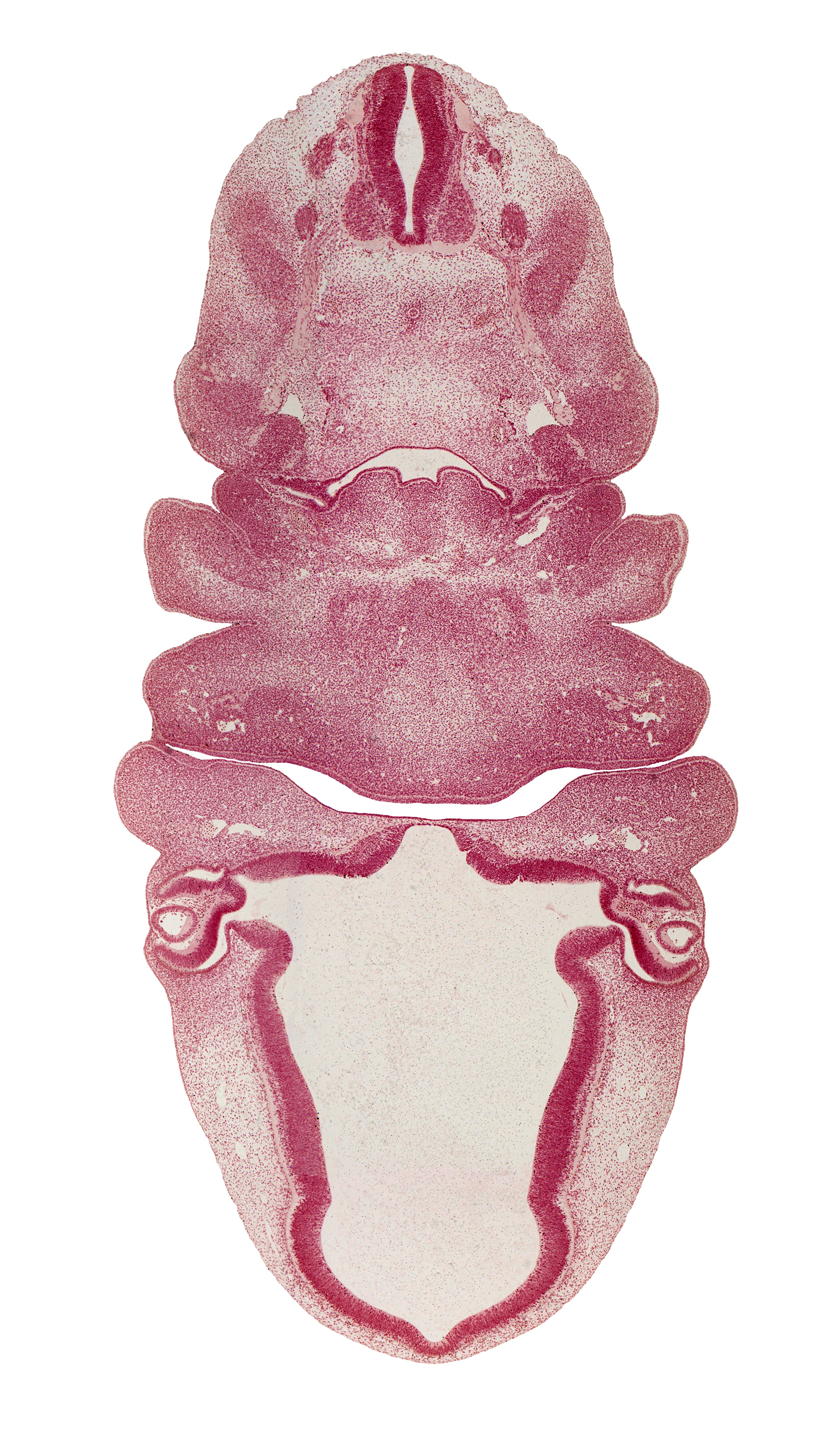 C-3 spinal ganglion, aortic arch 3, arytenoid swelling, carotid duct, diencephalon, dorsal sulcus, edge of lens vesicle, epithalamus, hypaxial part of myotome, hypoglossal nerve (CN XII), intraretinal space (optic vesicle cavity), junction of intraretinal space (optic vesicle cavity) and optic stalk lumen (CN II), neural layer of retina, optic chiasma (chiasmatic plate), optic stalk lumen (CN II), pigmented layer of retina, pineal bud, precardinal vein, premuscle mass of tongue, retinal fissure, terminal branches of mandibular nerve (CN V₃), thyroglossal duct, ventral part of pharyngeal pouch 3 becomes thymus gland, vertebral artery