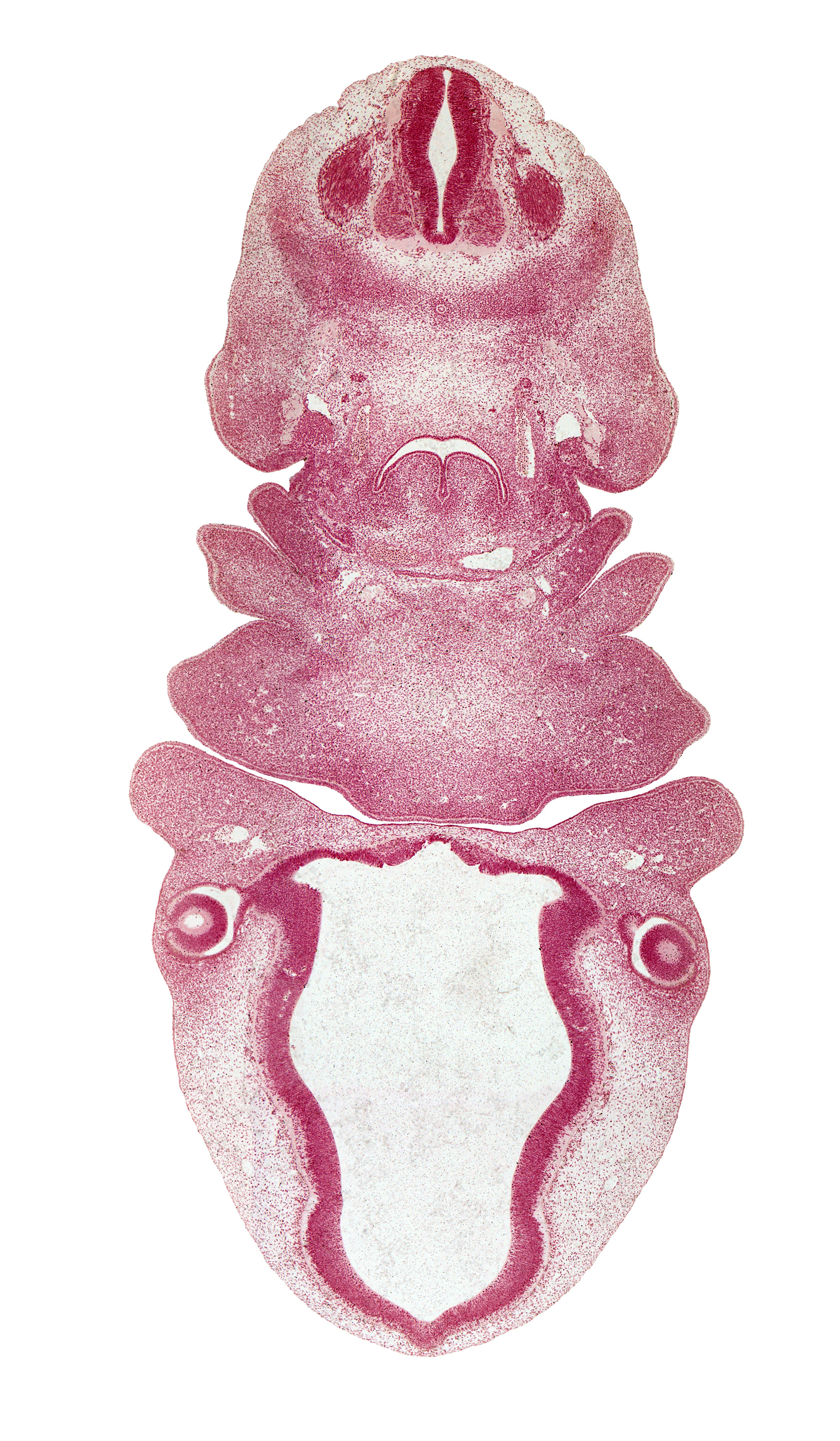 C-3 spinal ganglion, aortic arch 4, bilobed thyroid gland, caudal edge of pharyngeal arch 3, caudal edge of pharyngeal arch 4, cervical sinus, condensation around optic cup, dense caudal part of sclerotome, epithalamus, horn of aortic sac, intermediate zone, mandibular prominence of pharyngeal arch 1, marginal zone, maxillary prominence of pharyngeal arch 1, maxillary vein, medial eminence, oral fissure, oronasal cavity, pharyngeal arch 2, pineal bud, surface ectoderm, sympathetic trunk, ventricular zone