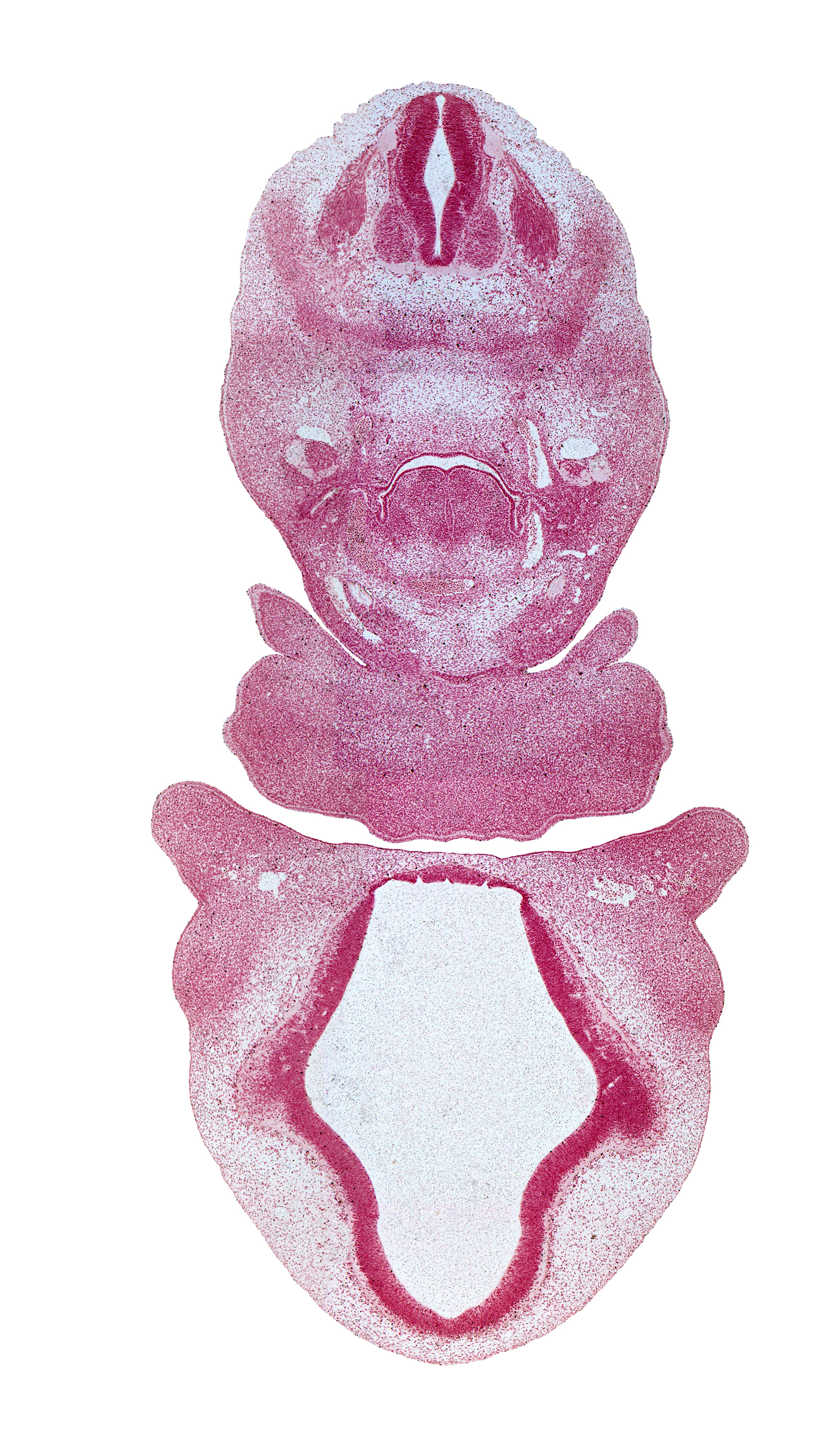 C-3 spinal ganglion, aortic arch 6, caudal edge of pharyngeal arch 2, central canal, cephalic edge of pericardial cavity, diencephalon, dorsal aorta, edge of median mandibular groove, hypoglossal nerve (CN XII), laryngeal condensation, lateral ventricle, maxillary vein, myotome, notochord, oral fissure, oronasal cavity, pharyngeal pouch 4 (dorsal part becomes superior parathyroid gland), pharyngeal pouch 4 (ventral part), pre-optic area, precardinal vein, telencephalon, third ventricle, transition region, vagus nerve (CN X)