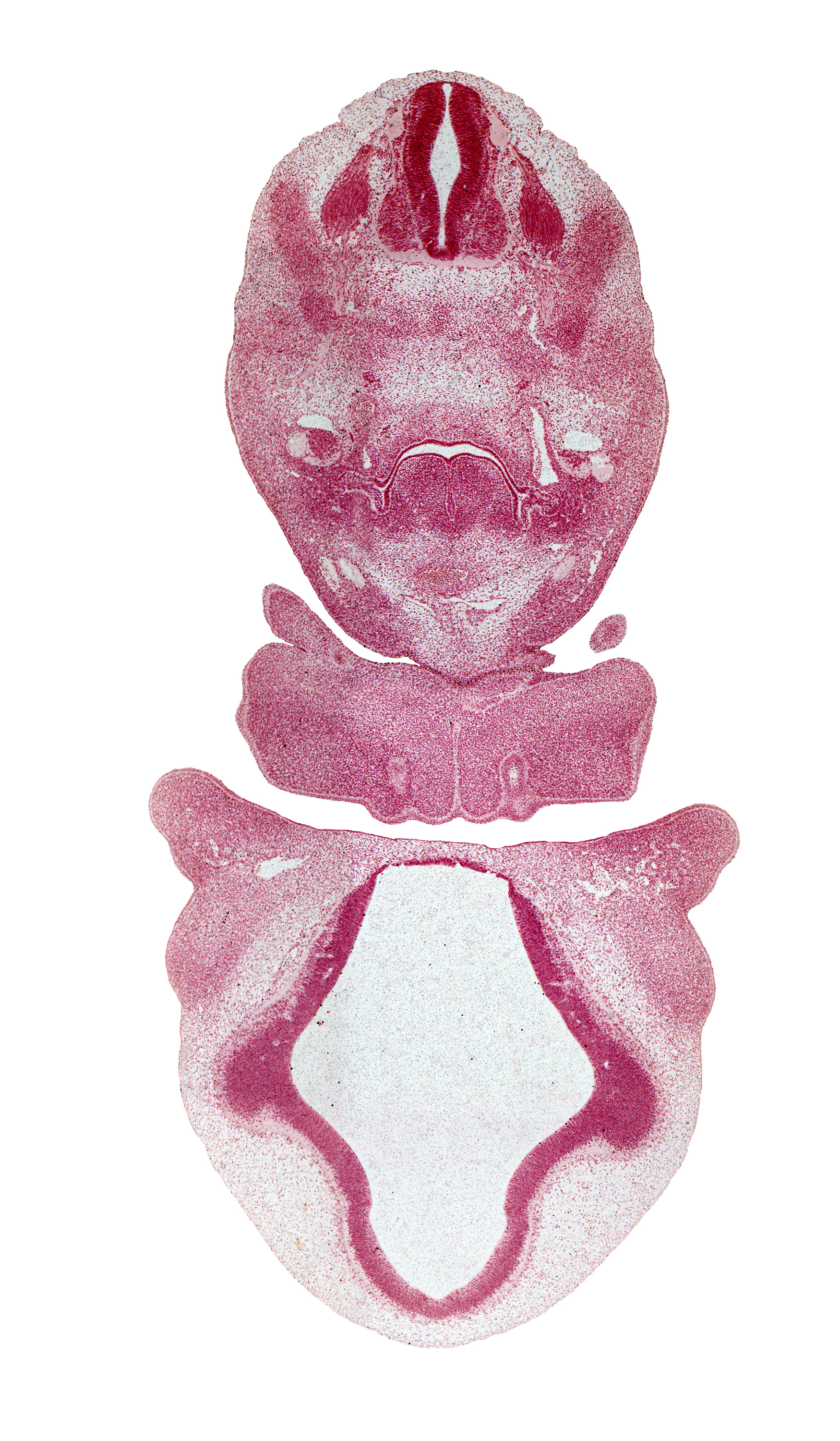 C-3 spinal ganglion, C-3 ventral primary ramus, aortic arch 6, aortic sac, dermatome, hypoglossal nerve (CN XII), lamina terminalis, laryngeal condensation, laryngeal pharynx, lateral nasal prominence, mandibular prominence of pharyngeal arch 1, maxillary prominence of pharyngeal arch 1, maxillary venous plexus, median mandibular groove, nasomaxillary groove, oral fissure, pericardial cavity, precardinal vein, primordial meninx, vagus nerve (CN X), ventral root