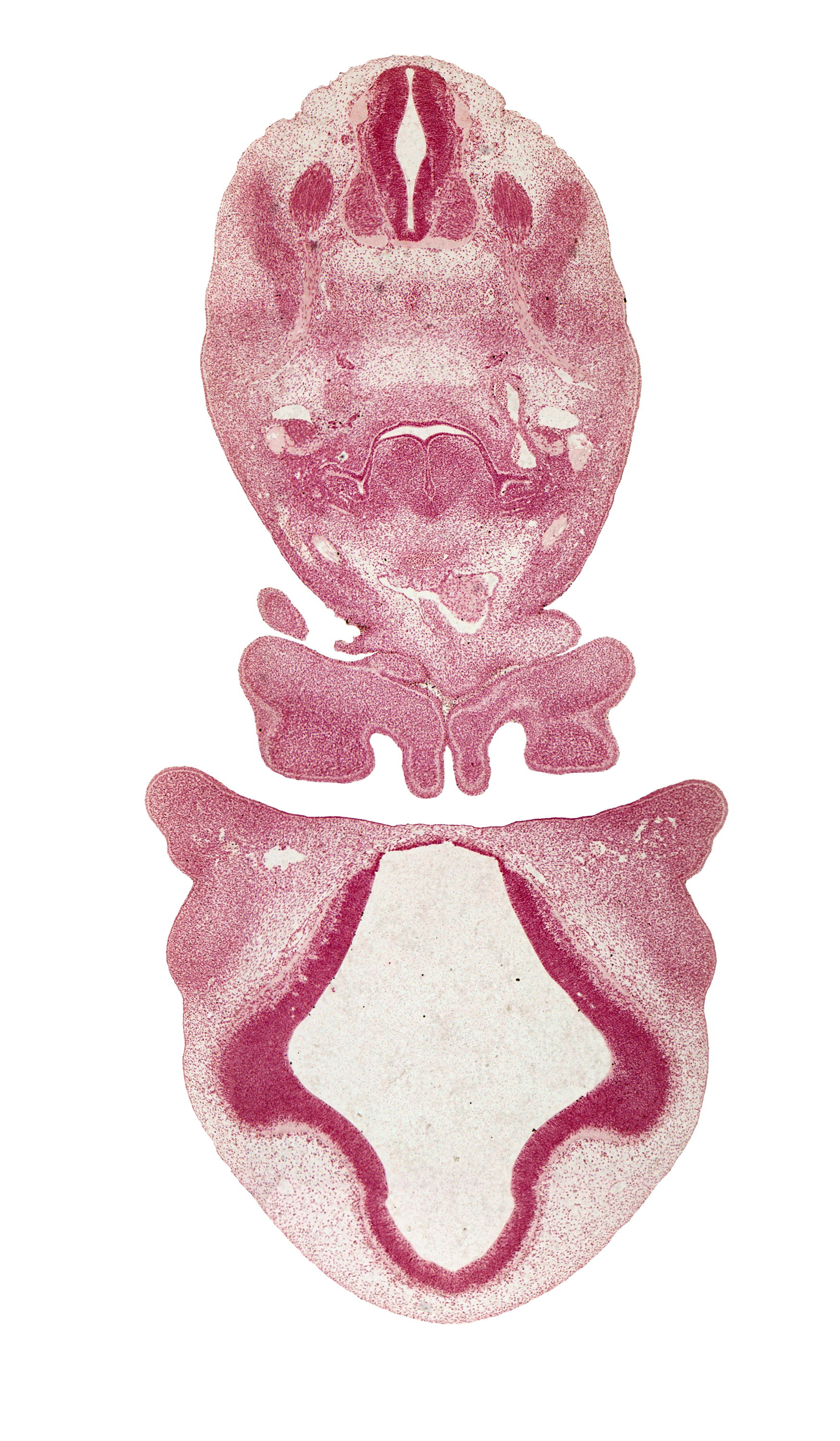 C-3 / C-4 interganglion region, aortic arch 6, caudal edge of C-3 spinal ganglion, caudal edge of mandibular prominence of pharyngeal arch 1, cephalic edge of C-4 spinal ganglion, cervical plexus, diencephalon, dorsal aorta, edge of cerebral vesicle (telencephalon), edge of oronasal cavity, hypoglossal nerve (CN XII), junction of aortic sac and ascending aorta, junction of diencephalon and telencephalon, junction of maxillary and medial nasal prominences, lamina terminalis, maxillary venous plexus, precardinal vein, spinal accessory nerve (CN XI), sympathetic trunk, transition region, ultimopharyngeal pouch