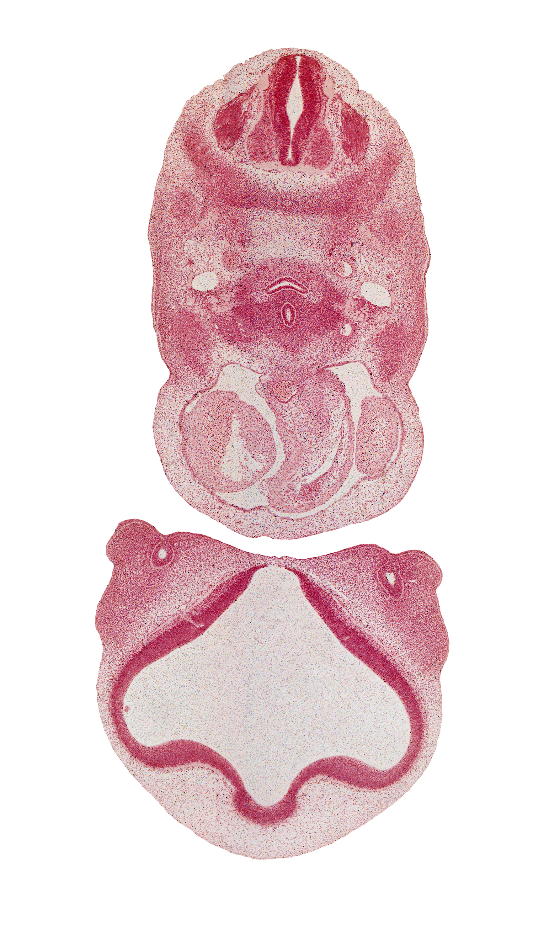 C-4 spinal ganglion, alar plate(s), aorticopulmonary septum, ascending aorta, basal plate, dense caudal part of sclerotome, dorsal aorta, floor plate, interventricular foramen, lamina terminalis, lateral nasal prominence, lateral ventricle, left atrium, lumen of nasal sac, maxillary prominence of pharyngeal arch 1, medial nasal prominence(s), nasal fin, nasomaxillary groove, pericardial cavity, precardinal vein, right atrium, roof of third ventricle, roof plate, sulcus limitans, sympathetic trunk, third ventricle, undivided truncus arteriosus, vascular plexus