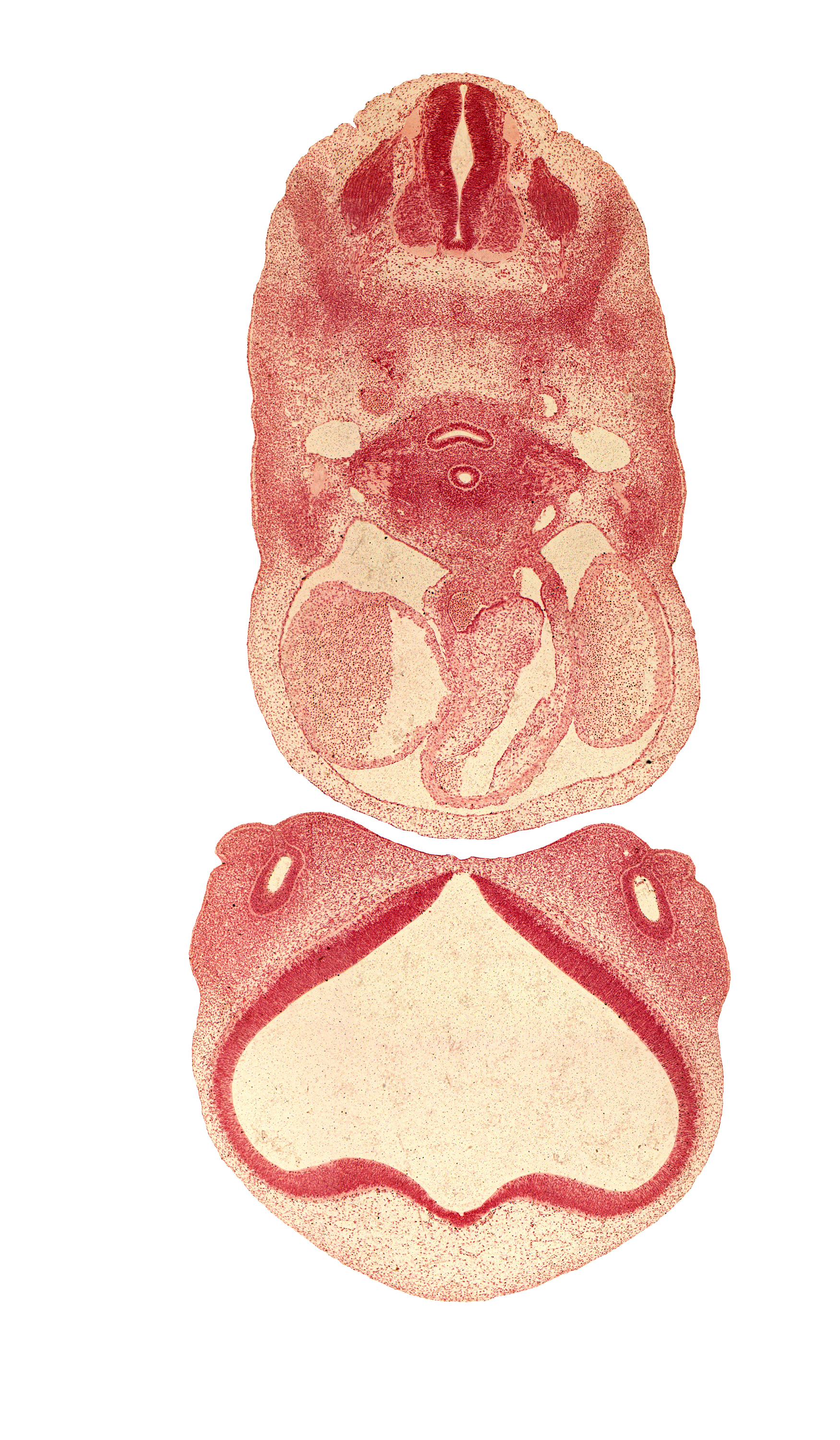 C-4 spinal ganglion, aorticopulmonary septum, blood cells, central canal, cerebral vesicle (telencephalon), conus cordis (proximal outflow tract), dorsal aorta, ectoderm, lateral ventricle, left atrium, lumen of nasal sac, medial nasal prominence(s), nasal capsule, pericardial cavity, precardinal vein, primordial meninx, right atrium, semilunar valve region, sympathetic trunk, third ventricle, undivided truncus arteriosus (distal outflow tract), vagus nerve (CN X), vascular plexus