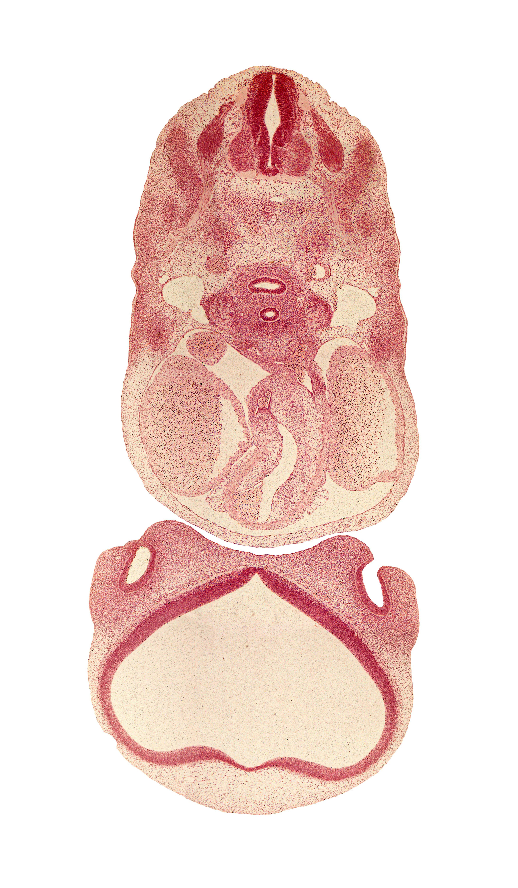 C-4 spinal ganglion, aorticopulmonary septum, archipallium, ascending aorta, conus cordis (proximal outflow tract), dorsal aorta, dorsal fasciculus, dorsal primary ramus, dorsal root(s), esophagus, lateral nasal prominence, nasal capsule, nasal sac, olfactory area, paleopallium, paraphysial arch, pericardial cavity, pulmonary trunk, right atrium, right pulmonary artery, trachea, truncus arteriosus (distal outflow tract), ventral primary ramus, ventral root