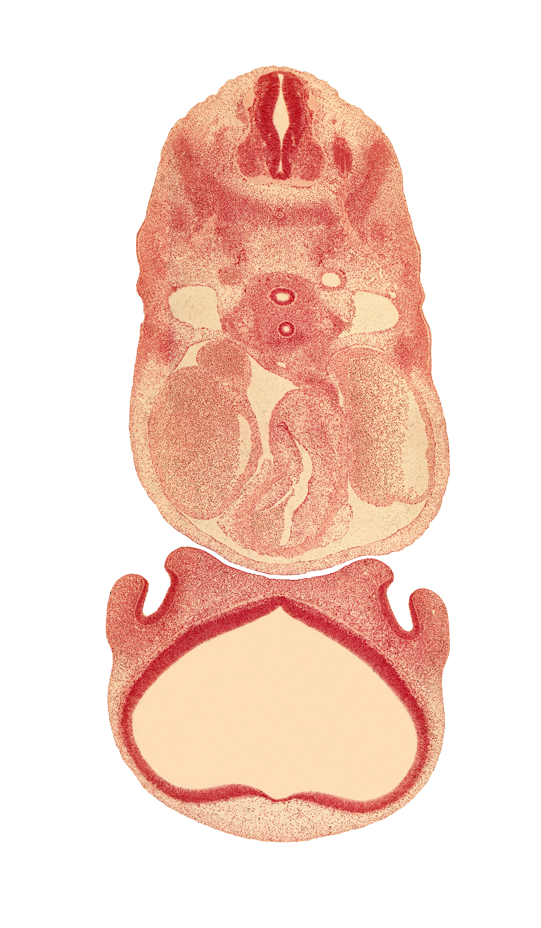 archipallium, caudal edge of C-4 spinal ganglion, central canal, cerebral vesicle (neopallium), cervical plexus, esophagus, infrahyoid premuscle mass, intermediate zone, left atrium, marginal zone, naris, nasal disc (olfactory placode), nasal sac, paleopallium, pericardial cavity, primordial meninx, right atrium, sinus venosus, sympathetic trunk, trachea, ventricular zone