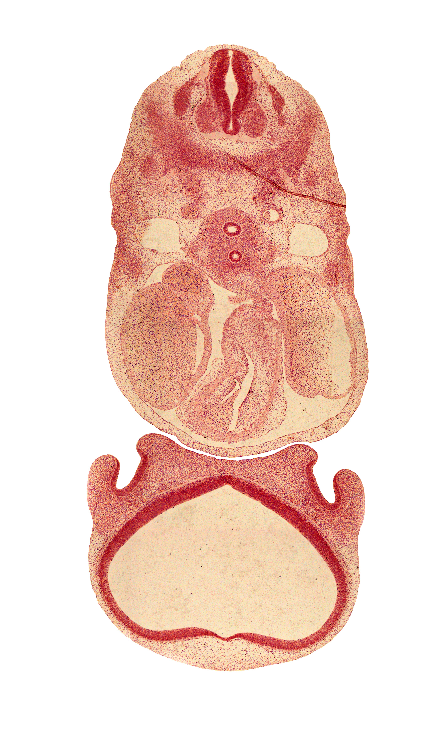 alar plate(s), basal plate, cephalic edge of C-5 spinal ganglion, conus cordis (proximal outflow tract), dorsal aorta, esophagus, floor plate, head mesenchyme, heart prominence, interventricular foramen, lateral nasal prominence, left atrium, medial nasal prominence(s), mesenchymal condensation around hindgut, olfactory area, precardinal vein, primordial meninx, right atrium, roof plate, sinus venosus, sulcus limitans, sympathetic trunk, trachea, truncus arteriosus (distal outflow tract), ventral primary ramus