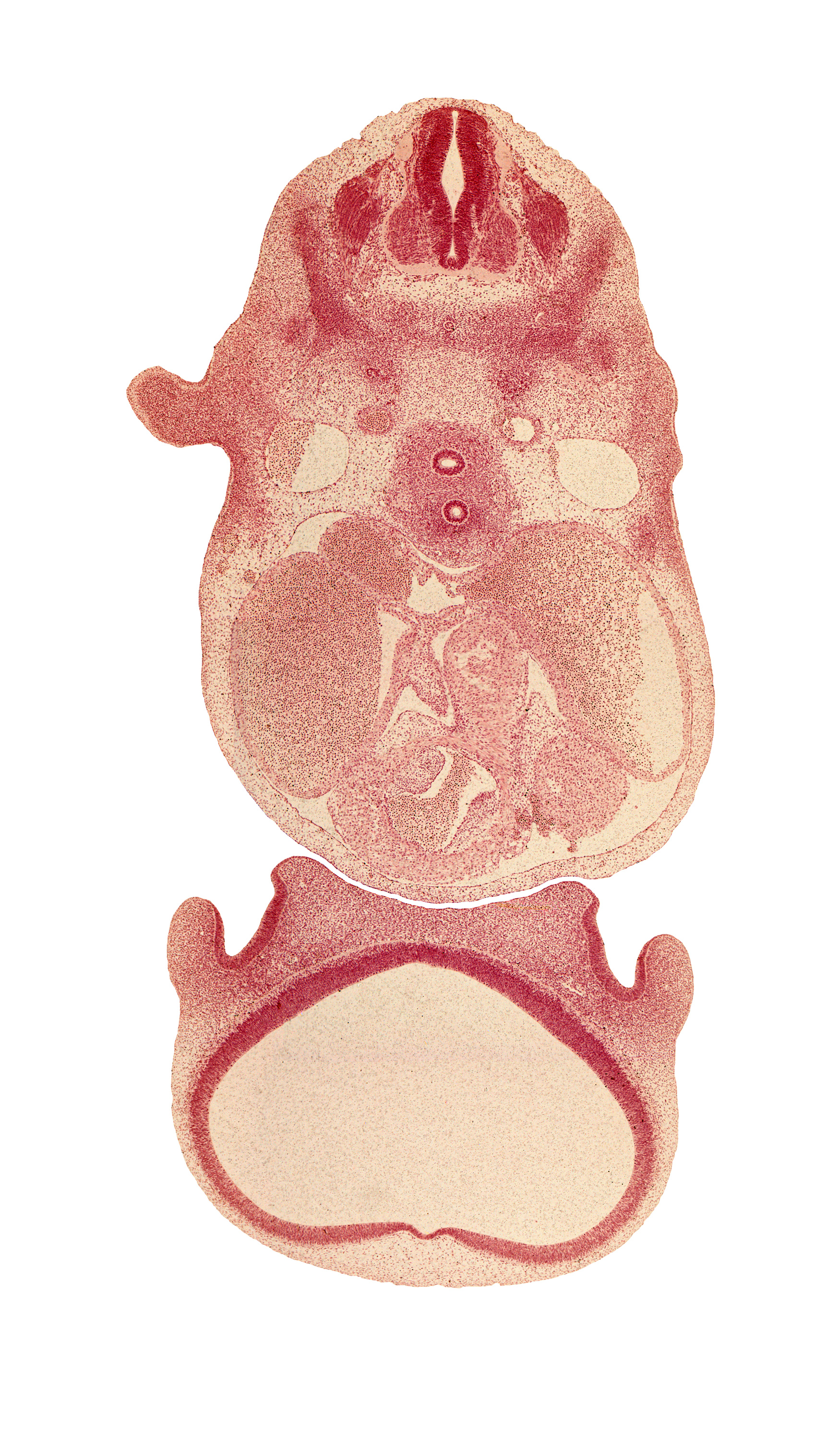 C-5 spinal ganglion, aortic vestibule of left ventricle, blood cells, cerebral vesicle (telencephalon), cornu Ammonis, dorsal aorta, gyrus dentatus, infundibulum of right ventricle, left atrium, naris, notochord, olfactory sac, precardinal vein, right atrium, sinus venosus, transverse sinus, tuberculum olfactorium