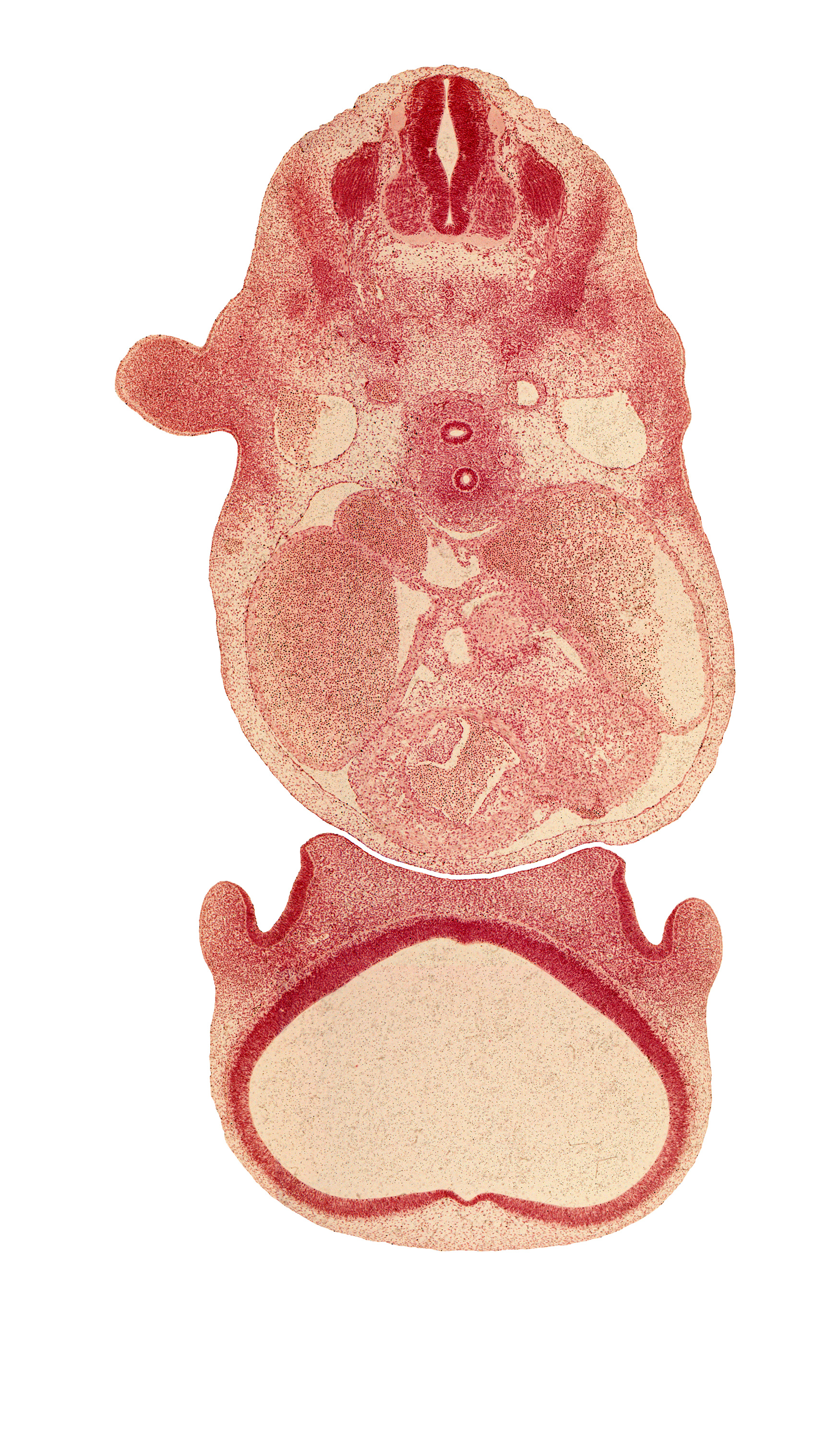 C-5 spinal ganglion, aortic vestibule of right ventricle, dorsal aorta, esophagus, heart prominence, infundibulum of right ventricle, lateral ventricle, left atrium, nasal disc (olfactory placode), phrenic nerve, precardinal vein, region of olfactory filia (CN I), right atrium, secondary interatrial septum (septum secundum), sinus venosus, sympathetic trunk, telencephalon medium, trachea