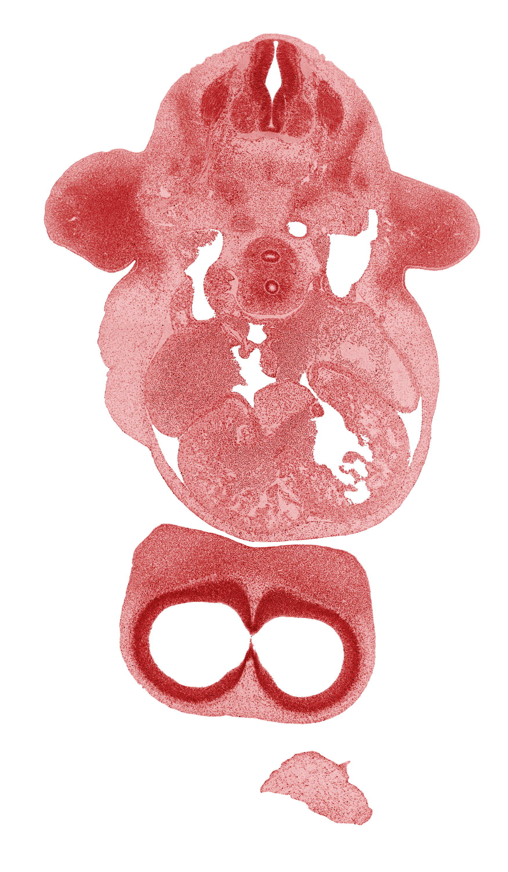 C-6 spinal ganglion, cerebral vesicle (telencephalon), frontal prominence, heart prominence, interventricular foramen, interventricular sulcus, junction of postcardinal vein and right common cardinal vein, left atrioventricular canal, left common cardinal vein, loose cephalic part of sclerotome, notochord, phrenic nerve, postcardinal vein, precardinal vein, primary interatrial septum (septum primum), right atrioventricular canal, right atrium, sinus venosus, skeletal blastema of humerus, telencephalon medium, tuberculum olfactorium, upper limb