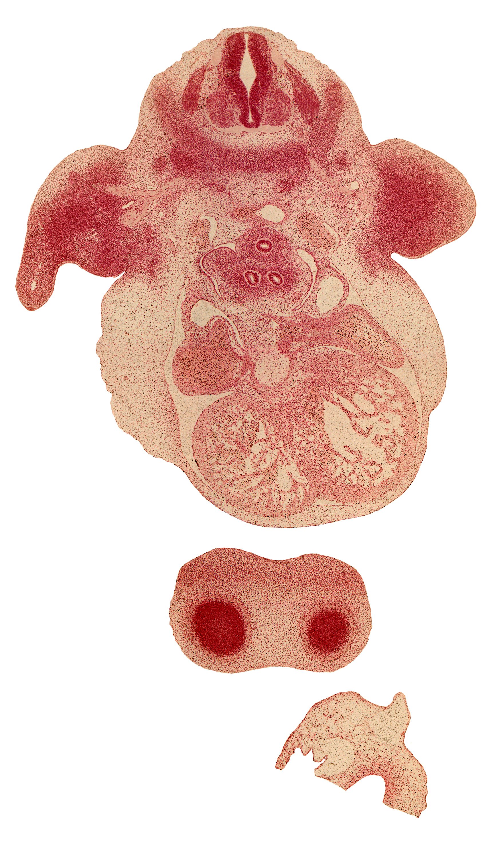 C-6 spinal ganglion, C-6 ventral primary ramus, atrioventricular sulcus, axial artery, brachial plexus, central canal, cerebral vesicle (telencephalon), common pulmonary vein, dorsal aorta, epaxial part of myotome, heart prominence, interventricular septum, interventricular sulcus, left atrium, left common cardinal vein, left primary bronchus, marginal vein, neural arch, pleuropericardial fold, postcardinal vein, primordial pleural cavity, right atrium, right lung sac, right primary bronchus, right pulmonary artery, upper limb