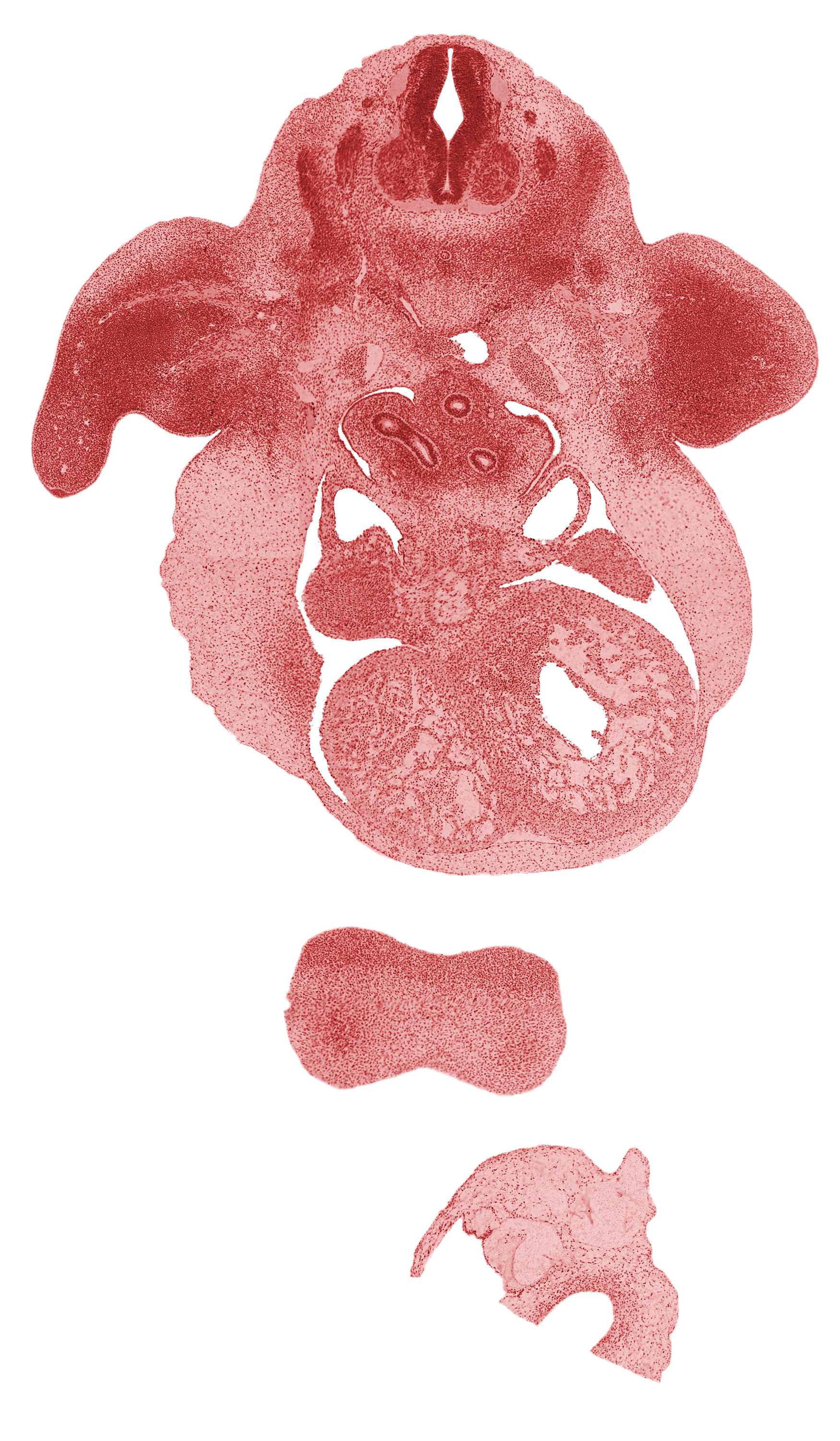 aorta, apical epidermal ridge, caudal edge of C-6 spinal ganglion, central canal, edge of cerebral vesicle(s), frontal prominence, interventricular sulcus, left common cardinal vein, left venous valve, marginal vein, mesocardium, muscular part of interventricular septum, pericardial cavity, pleuropericardial membrane, postcardinal vein, primordial pleural cavity, radial nerve, right atrium, sinus venosus, trabecular part of left ventricle, trabecular part of right ventricle, ulnar nerve, upper secondary bronchus bud