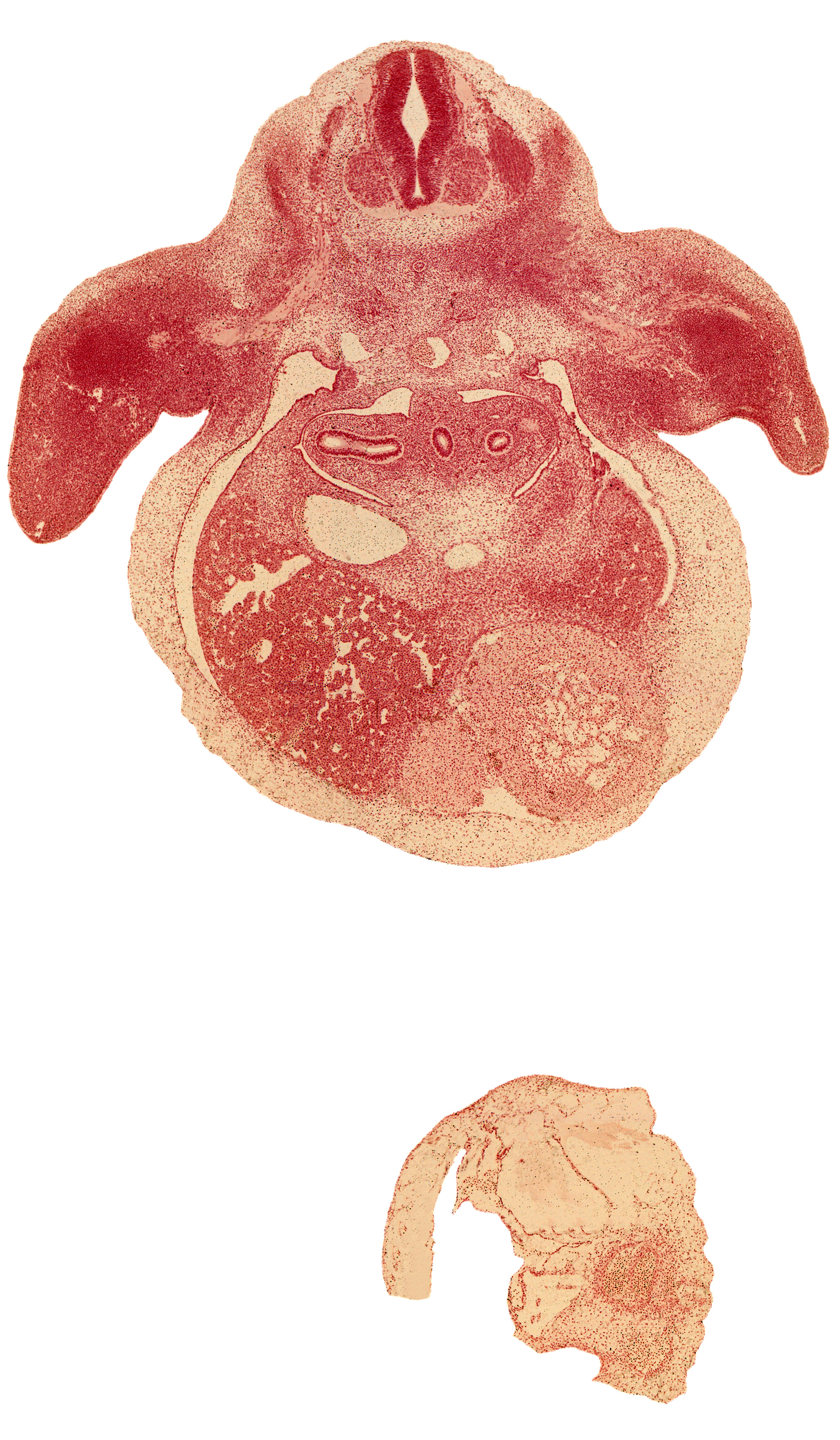 C-7 spinal ganglion, aorta, brachial plexus, central canal, edge of left lobe of liver, edge of pericardial cavity, esophagus, forearm, hepatic part of inferior vena cava, left ventricle, lower secondary bronchus bud, middle secondary bronchus bud, pericardial cavity, peritoneal cavity, postcardinal vein, primordial pleural cavity, radial nerve, right lobe of liver, right ventricle, skeletal blastema of humerus, sympathetic trunk