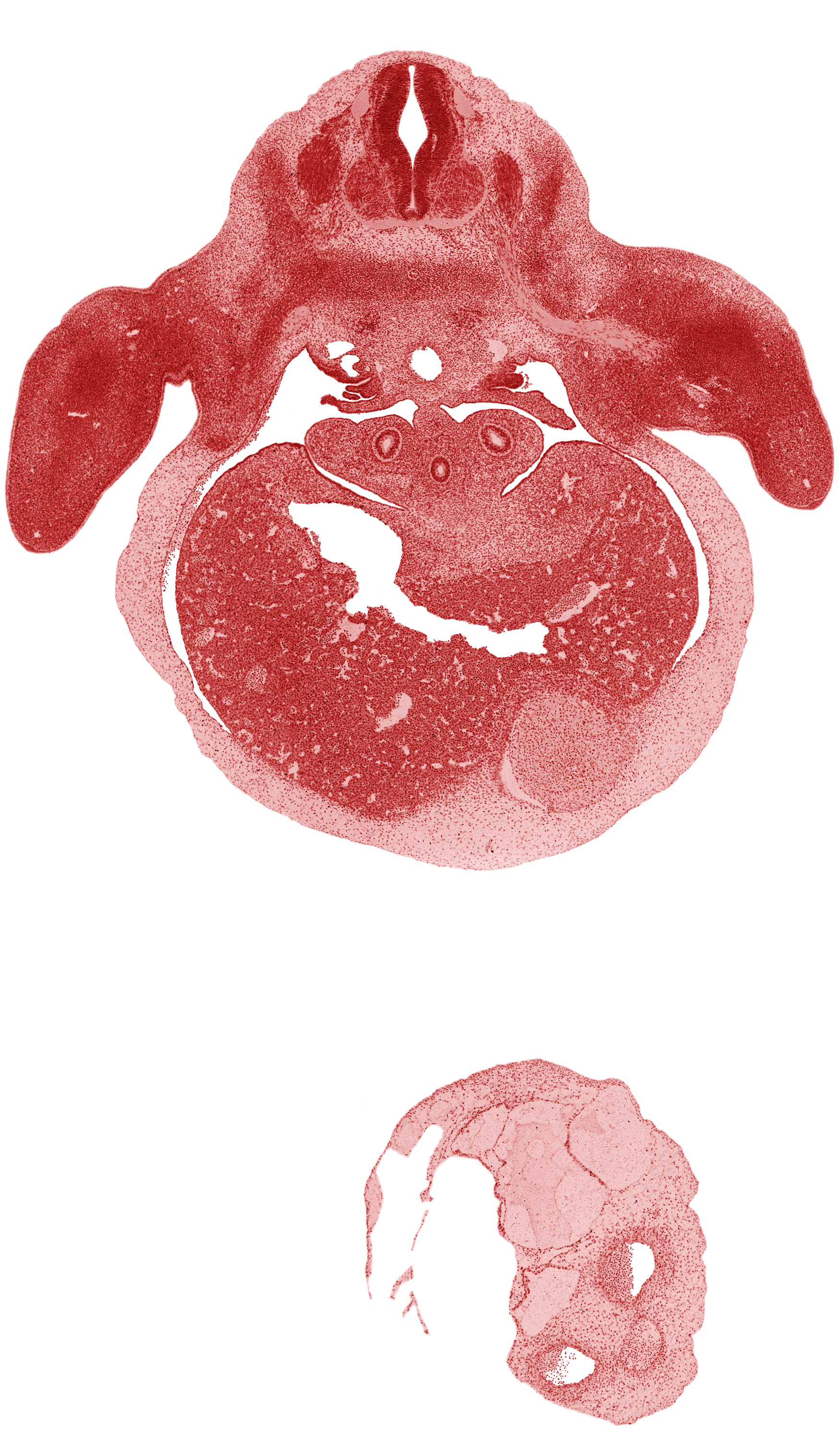 C-8 spinal ganglion, C-8 ventral primary ramus, alar plate(s), aorta, basal plate, brachial plexus, central canal, left lobe of liver, left ventricle, liver prominence, lower secondary bronchus bud, median nerve, pericardial cavity, peritoneal cavity, pleuroperitoneal opening, primordial paramesonephric groove, primordial pleural cavity, sulcus limitans, surface ectoderm