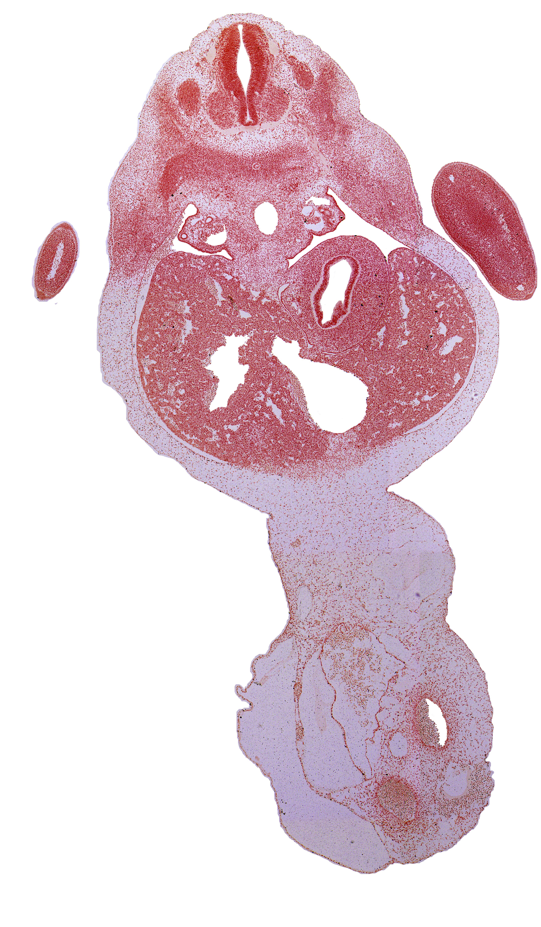 T-1 spinal ganglion, T-1 ventral root, T-2 intercostal nerve, T-2 spinal nerve, afferent hepatic vein, allantois, aorta, body of stomach, cephalic edge of gall bladder, ductus venosus, greater curvature of stomach, hepatic sinusoid, left umbilical artery, lesser curvature of stomach, marginal vein, mesonephros, right umbilical artery, suprarenal gland medulla, umbilical coelom, umbilical vein