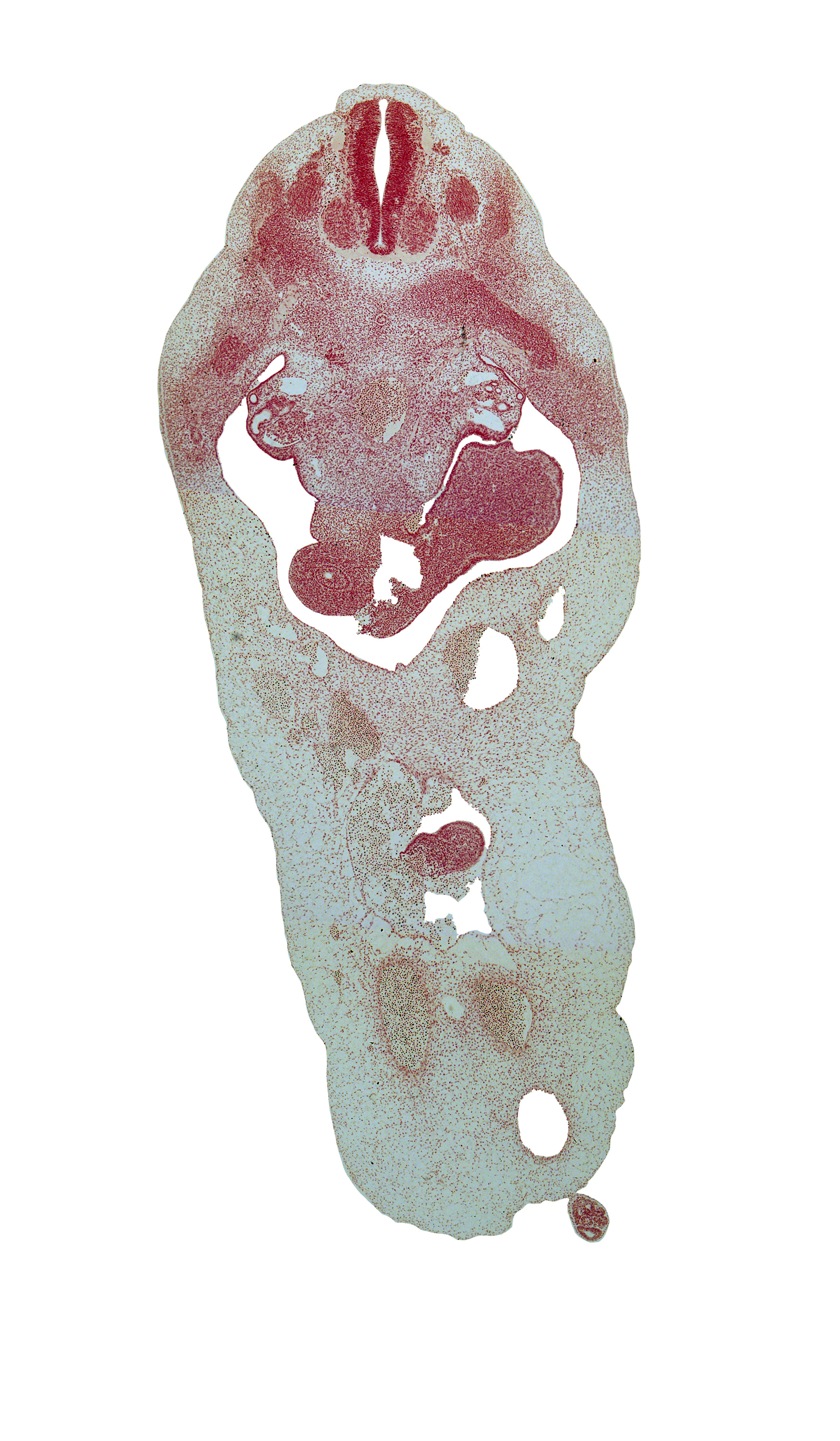 T-4 spinal ganglion, aorta, blastema of rib 5, duodenum, herniated midgut mesenchyme, mammary ridge, mesonephric duct, peritoneal cavity, primordial filum terminale, superior mesenteric vein, sympathetic trunk, umbilical coelom, umbilical cord, umbilical vein