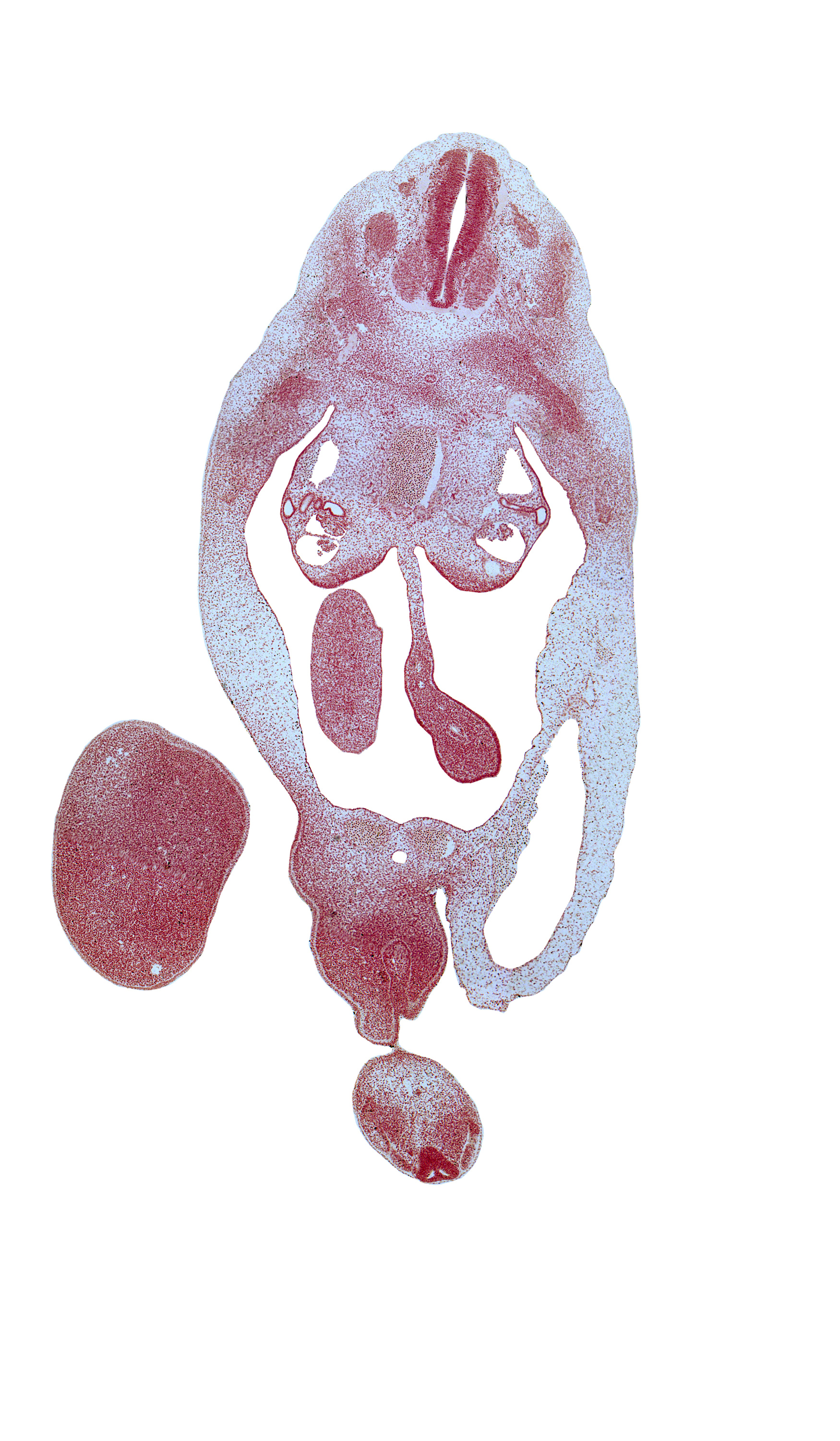 T-6 dorsal root, T-7 ventral root, anal fold, anal pit, blastema of rib 8, caudal eminence, caudal part of umbilical coelom, central canal, cloacal membrane, distal limb of herniated midgut, dorsal mesentery, gonadal ridge, junction of allantois and urogenital sinus, labioscrotal swelling, left umbilical artery, loose cephalic part of sclerotome, lower limb, mesenchymal condensation in midgut mesentery, notochord, right umbilical artery