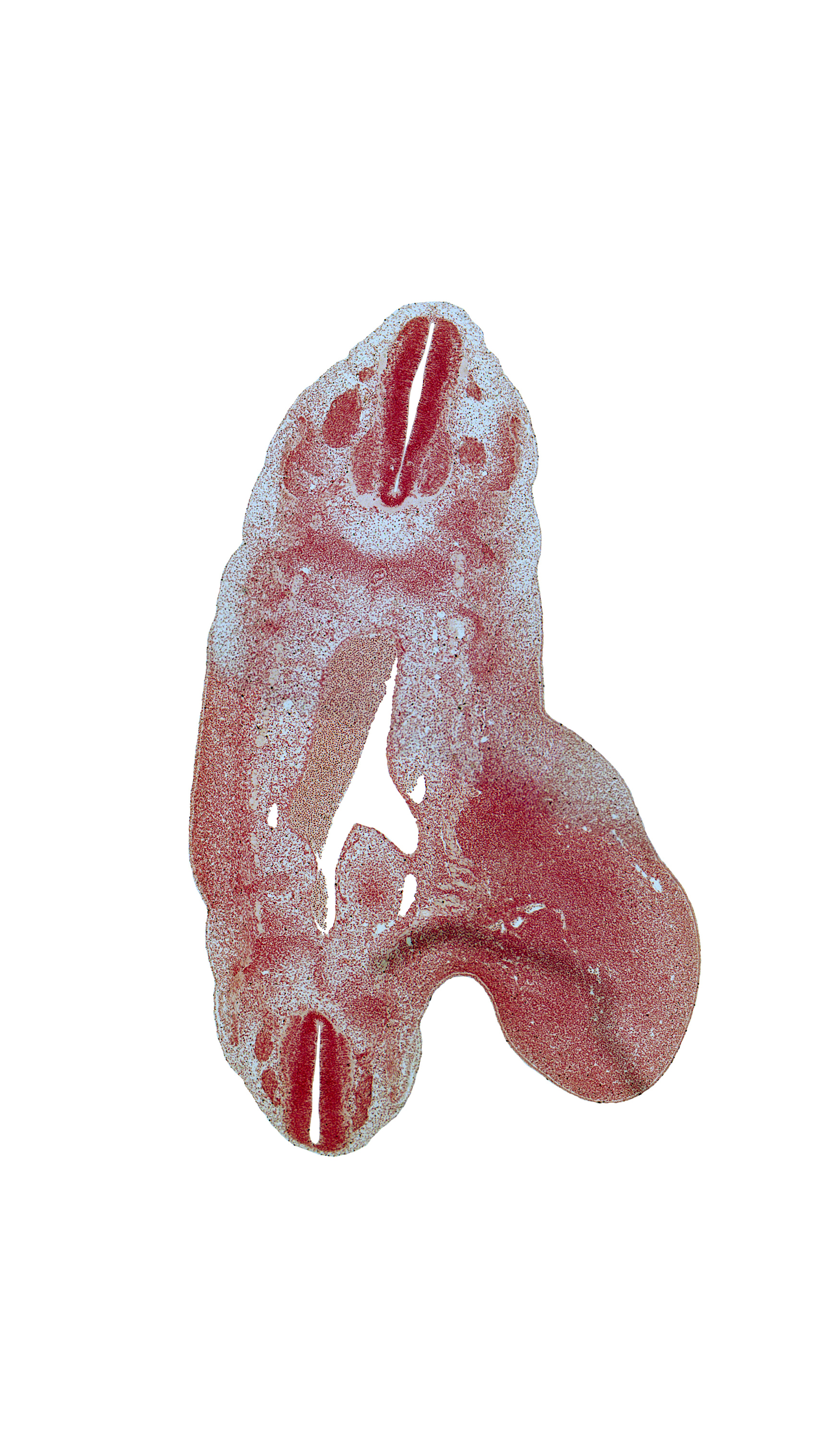 L-1 ventral primary ramus, S-3 spinal ganglion, T-10 dorsal root, T-11 spinal ganglion, T-12 spinal nerve, dense caudal part of sclerotome, edge of metanephrogenic blastema, lumbar plexus, lumbosacral plexus, median sacral artery, notochord, postcardinal vein, rib 12 blastema, sympathetic neuroblasts