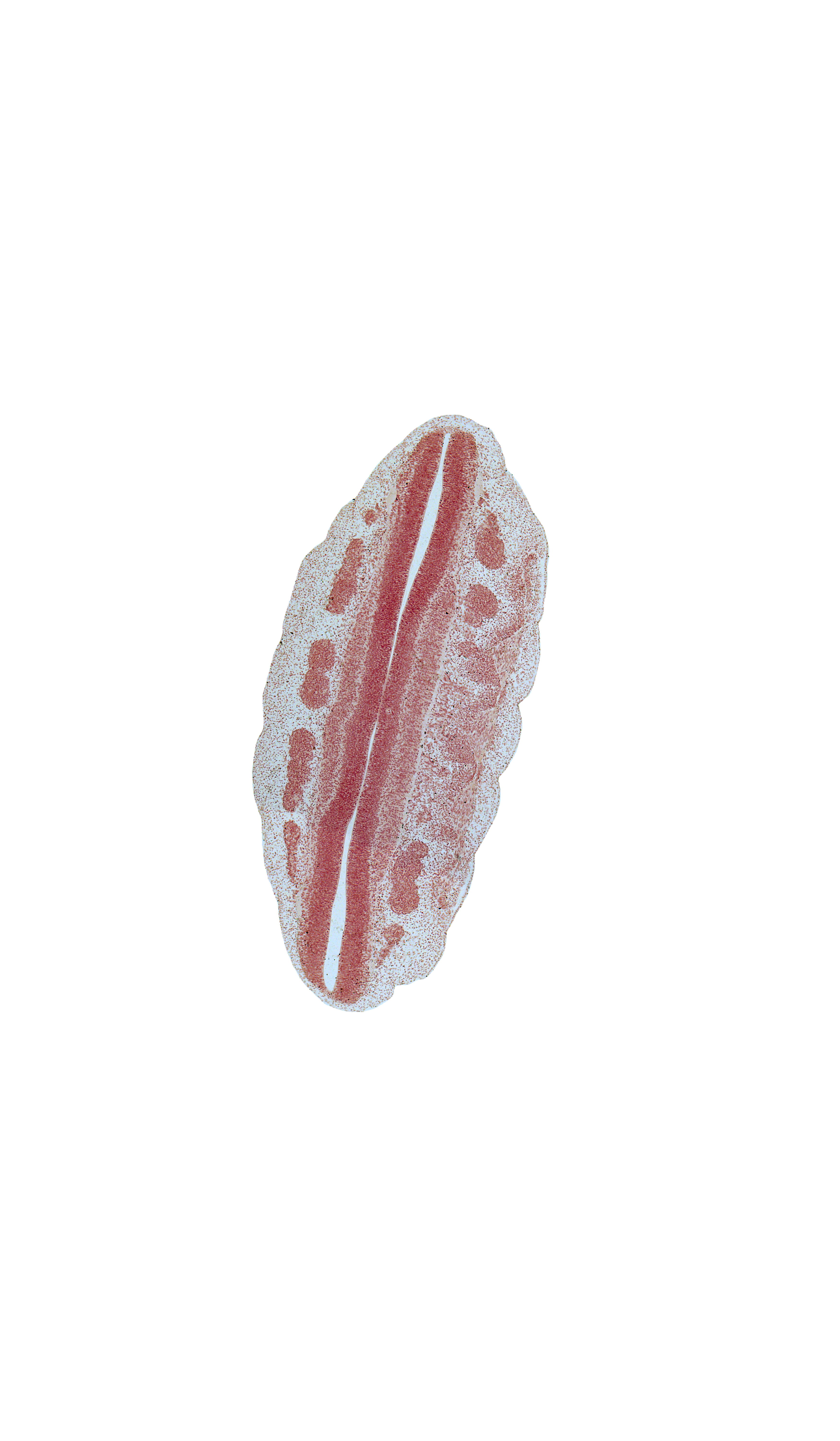 L-1 spinal ganglion, L-2 spinal ganglion, L-3 ventral root, L-4 ventral root, L-5 spinal ganglion, S-1 spinal ganglion, alar plate(s), basal plate, central canal, interganglion region, roof plate