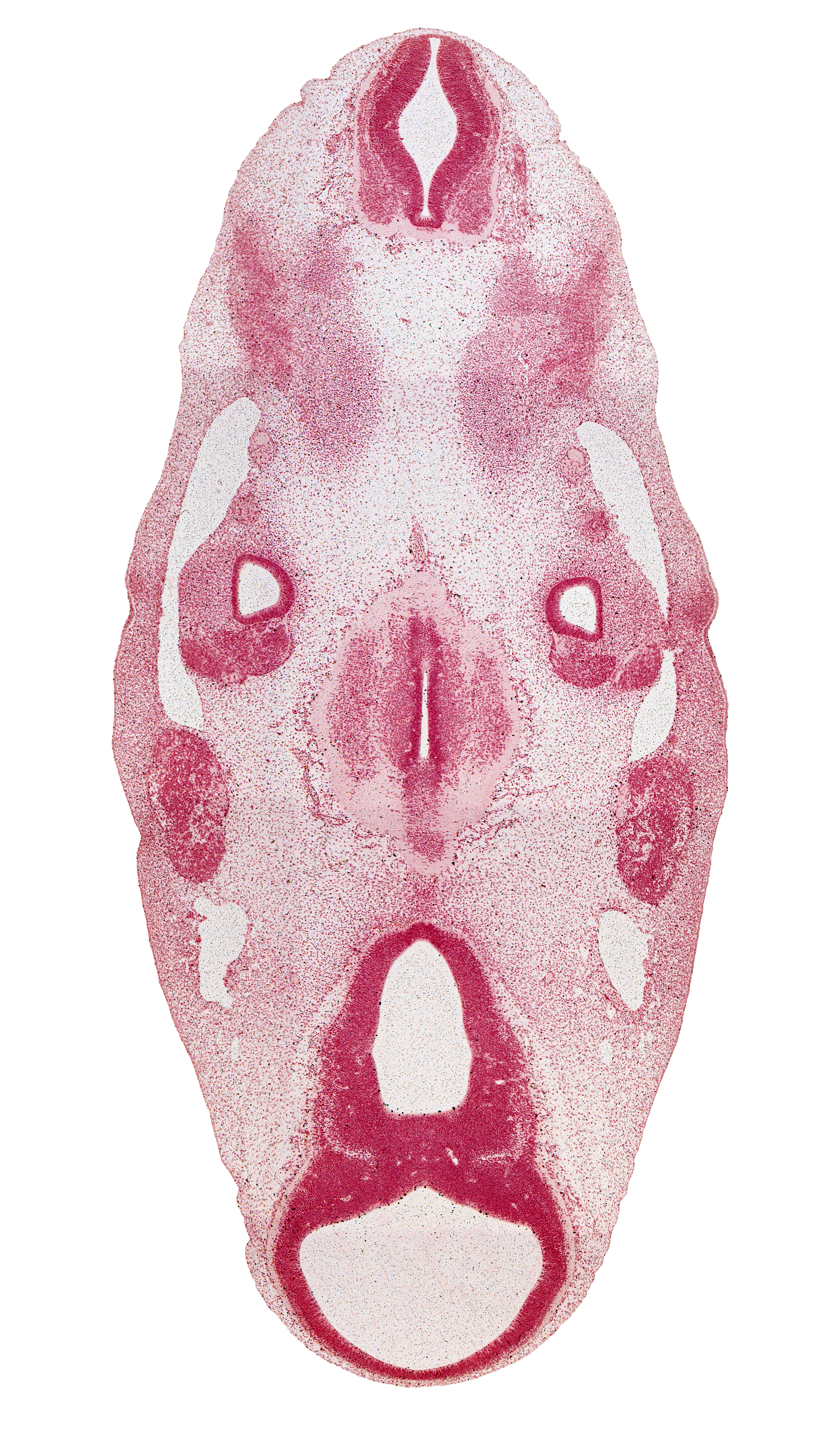 C-1 spinal ganglion, accessory nerve (CN XI), basilar artery, caudal edge of rhombencoel (fourth ventricle), central canal, dorsal root(s), geniculate ganglion (CN VII), hypothalamus, inferior ganglion of glossopharyngeal nerve (CN IX), intermediate zone, marginal zone, mesencephalon (M1), mesencoel (cerebral aqueduct), motor root of trigeminal nerve (CN V), neurohypophyseal bud, occipital myotome, oculomotor nerve (CN III), parachordal condensation, subthalamus, sulcus limitans, third ventricle, trigeminal ganglion (CN V), trochlear nerve (CN IV), vagus nerve (CN X), ventral root, ventral thalamus, ventricular zone