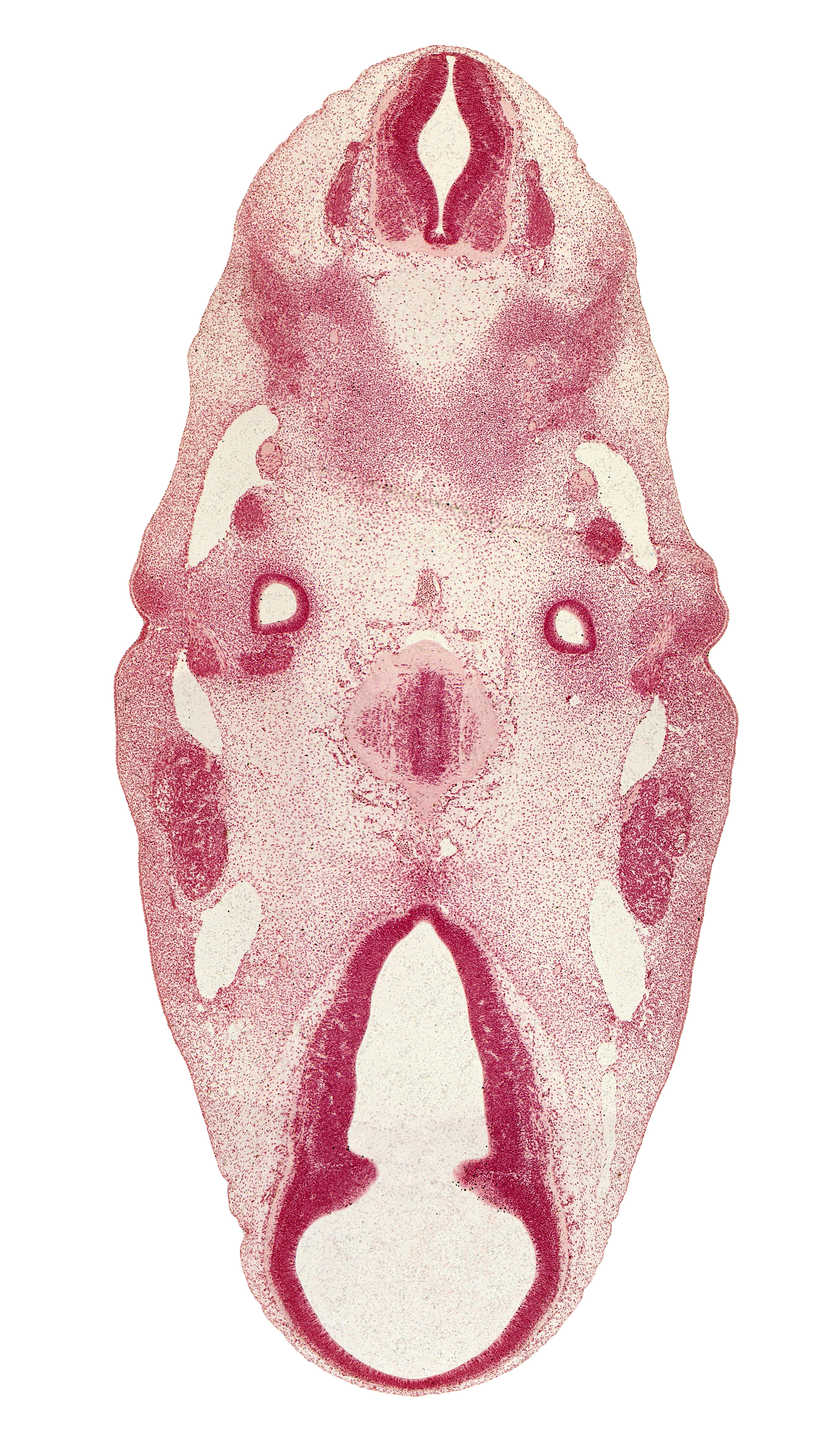 C-1 spinal ganglion, abducens nerve (CN VI), dorsal fasciculus, dorsal part of mesencephalon (M1), dorsal thalamus, epipharyngeal placode, facial nerve (CN VII), hypothalamus, inferior ganglion of glossopharyngeal nerve (CN IX), intermediate zone, marginal zone, middle sulcus, notochord, oculomotor nerve (CN III), otic capsule condensation, parachordal condensation, pharyngeal groove 1, pons region (metencephalon), primary head vein, root of hypoglossal nerve (CN XII), third ventricle, trochlear nerve (CN IV), ventral (hypothalamic) sulcus, ventral thalamus, ventricular zone