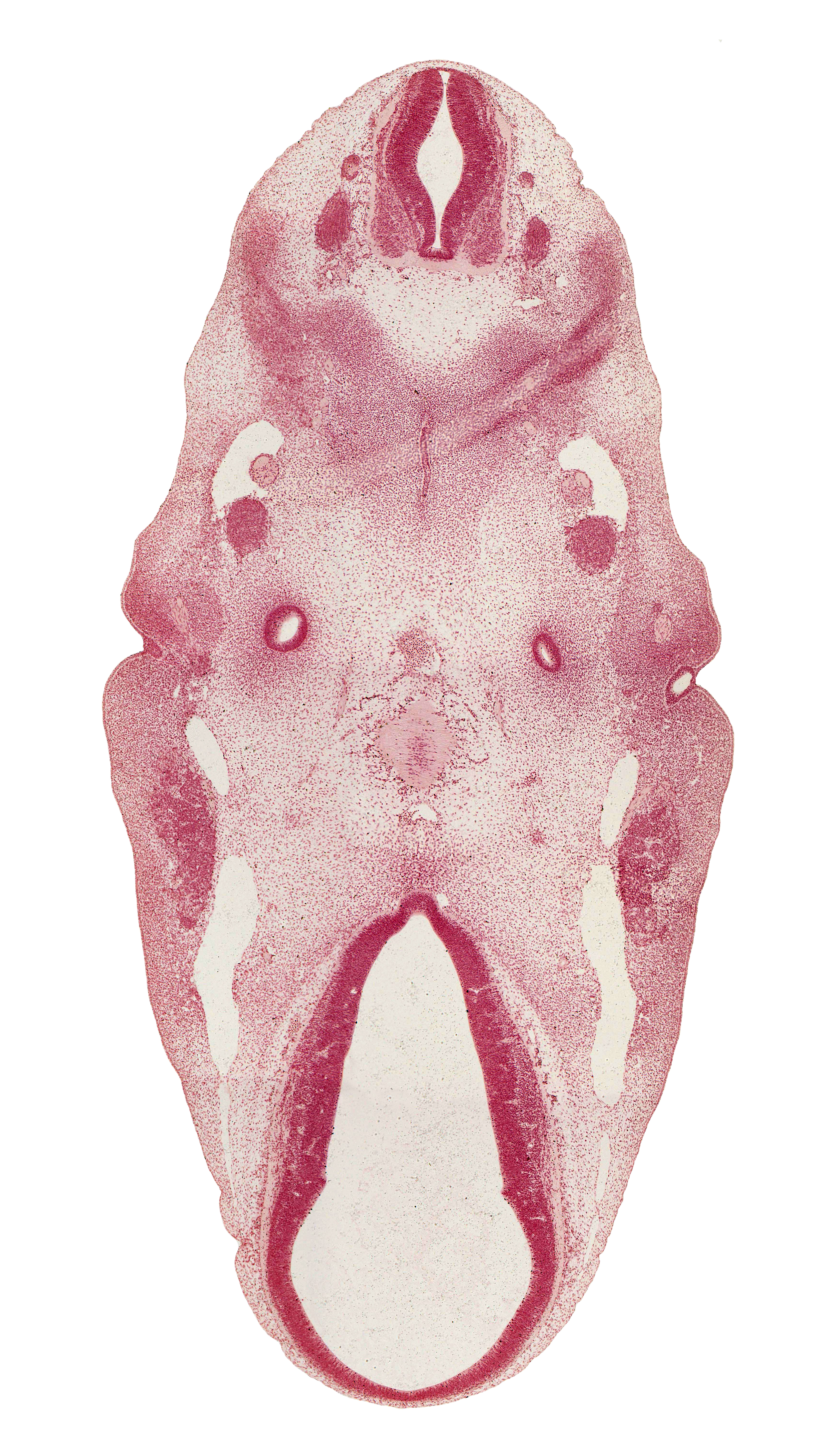 C-1 spinal nerve, abducens nerve (CN VI), anterior dural venous plexus, auricular hillock, caudal edge of C-1 spinal ganglion, caudal edge of cochlear part of otic vesicle, central canal, cephalic edge of lateral rectus premuscle mass, cephalic part of adenohypophysial pouch, cervical myotome, facial nerve (CN VII), inferior ganglion of glossopharyngeal nerve (CN IX), infundibular recess, junction of anterior dural venous plexus and primary head vein, junction of precardinal and primary head veins, mandibular nerve (CN V₃), maxillary nerve (CN V₂), neurohypophyseal bud, notochord, ophthalmic nerve (CN V₁), pharyngeal membrane 1, root of hypoglossal nerve (CN XII), sulcus limitans, third ventricle, vascular plexus